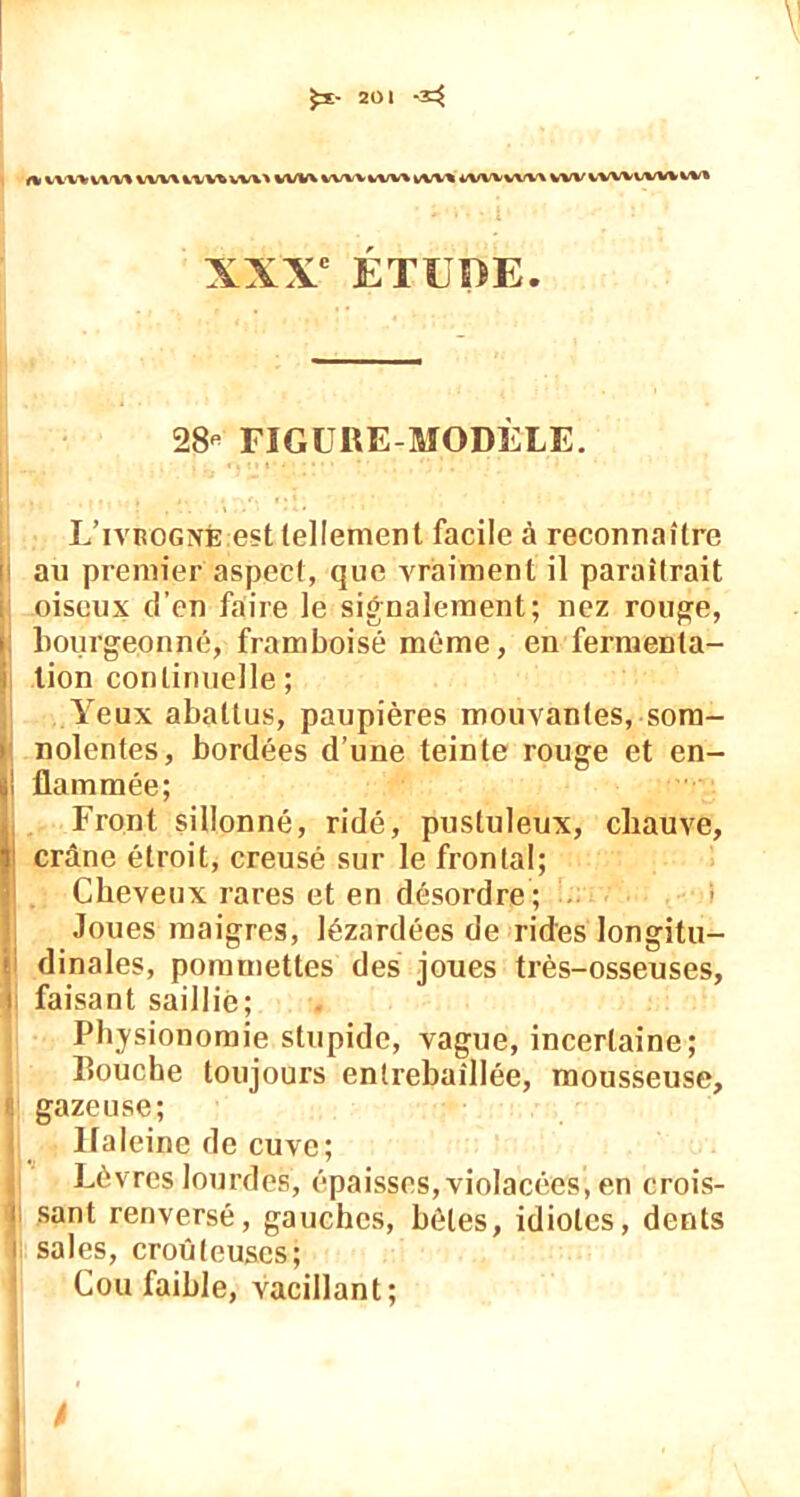 (lUUWWVVWWWVU^WVWiVVViWl^tVWVVWVWW^VWVlM XXXe ÉTUDE. 28- FIGURE-MODÈLE. L’ivuogxè est tellement facile à reconnaître au premier aspect, que vraiment il paraîtrait oiseux d’en faire le signalement; nez rouge, bourgeonné, framboise môme, en fermenta- tion continuelle ; Yeux abattus, paupières mouvantes, som- nolentes, bordées d’une teinte rouge et en- i flammée; Front sillonné, ridé, pustuleux, chauve, crâne étroit, creusé sur le frontal; Cheveux rares et en désordre ; 1 Joues maigres, lézardées de rides longitu- dinales, pommettes des joues très-osseuses, faisant saillie; Physionomie stupide, vague, incertaine; Bouche toujours entrebâillée, mousseuse, gazeuse; Haleine de cuve; Lèvres lourdes, épaisses, violacées, en crois- i sant renversé, gauches, hèles, idiotes, dents i sales, croûleuses; Cou faible, vacillant;