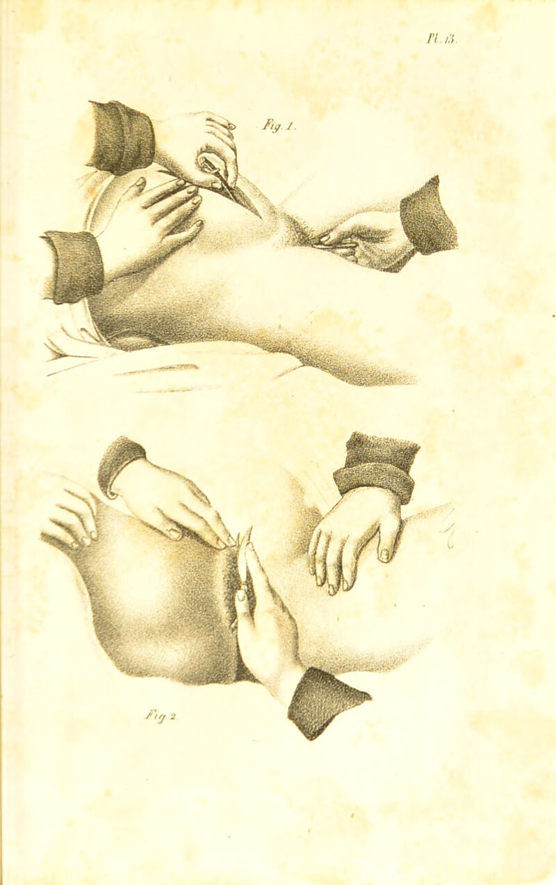 77. aï.