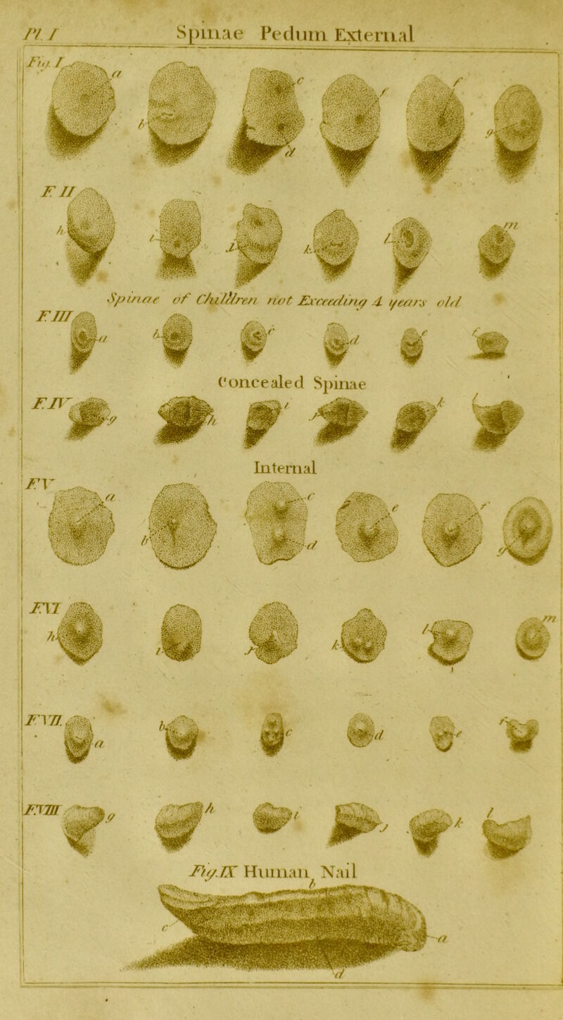 /y / Spiiiae Peduiri E^aemal Concealed Spime