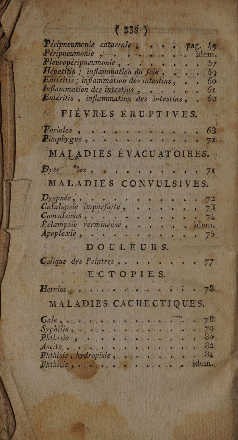 éripneumonie. UE ; inflammation du. y inflammation des i 4 mmation des intestins een tire à F es : iflammation des intestins ; + “MALADIES ÉVAGUATC MALADIE. s CONVULSIVES. #4 Dys PTS Le SRE RER 0 D te) IMpatjaite à!» 60la A at nt à Comulsions ÿ 4 Ait: 0 Ni RES clampsie vermineuse AE UN STE | | Apoplerie Ds 810 RU AT RM PATES ri: bé ER e $ D © ULE US seen ’ Clim à des Peintres GARE ri AR MR AS 4 A UC NOIR FE Le ) V'EANAt ad k si Eat ME NE mea #1 27 sh. é « NC din EN alles # 8 LE | MALADIES. CACHECTIQUES. Ga, Re A à HORITES ON SU AP Ne NU OR AL Phthisie ; A OA ET Ce PE * Ascite. 5 Phinisie