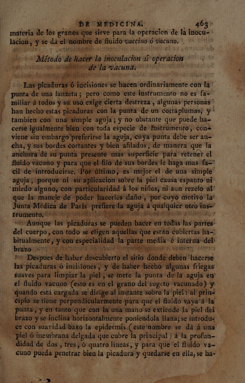 materia de los granos que sirve para la operacion de la iocus pes cQ se dá el nombre de fluido vaecíno ó Vacuno. *. | y EL m h ces | | Método dim la inoculación « 77 operacion nta ces ido o ind da: vacuna; LI TUM. db: p nl i TE m dilo od » Las teat incisiones se ON — P con fa | punta de una lanzeta; pero como este instrumento: no es fa- ^ miliar á todos y sa uso. exige c cierta destreza, algunas personas” 1 han hecho estas picaduras | con la punta de un cortàplümas; y: | tambien con una. simple aguja; y no obstante que puede ha- cerse igualmente sien con toda especie de Instrumento, con» viene sin embargo preferirse la aguja, cuya punta debe ser an= cha, y sus bordes cortantes y bien afilados, de manera que la anchura dé su punta resenté màs. — para retener el fluido vacuno y para que el filo de sus bordes le haga mas faz cil de“introducirse. Por último, es mejor el de una simple: aguja, porque ni su aplicacion: sobre la piel eausa espanto ni miedo alguno, con' particularidad á los niños, ni aun rezélo 'al' - que la maneje de poder hacerles daño, por cuyo motivo la Junta sess de París: T aguja á Y Pec cipi otro inge —À ES We Fee qc a phus á br diiduie- tie ipiéidifias se pueden hacer en tódás - god del cuerpo, con todo se eligen aquellas c que están cabiertas ha=i Metern | con especialidad la parte media'é m del brazo. a oW Bi ligur ^ conte entis - Despues 'déifisber: descubierto jet sitio donde deben lec | bá picaduras ó incisiones, y de haber hecho “algunas friegas suaves para. limpiar: la piel, “se mete. la punta de la. aguja eu el fluido vacuno (esto es en el grano del sugeto vacunado) y^ quando « está | cargada: se dirige al. instante: sobre la piel: “al priad | €ipio- Se tiene perpendicularmente. “para que el fluido vaya^á: la. puata, yy en tanto que “con là una mano'se extiende la piel del brazo y se inclina horizontalmente poniendola lana; se introdus - is ce con suavidad:baxo la epidermis.( este'nombre. se dá á una ^. piel ó fnembrana delgada: que cubre la principal ) á la profun- _didad de dos , tres, ó quatro líneas, y para que el fluido va- cuno pueda penetrar. bien la picadura y quedarse en ella, se ha- -