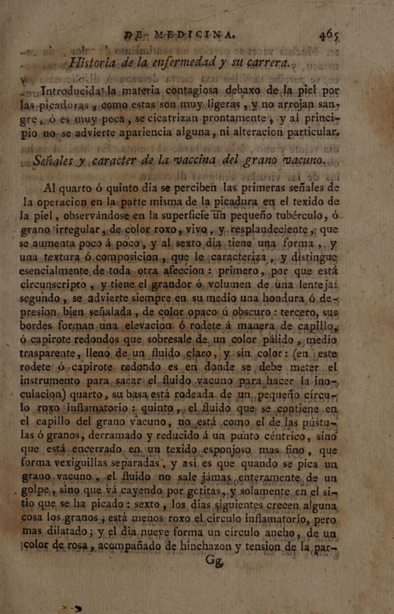 o ah: ole em tits QN us . Historia de la enfermedad T su | sarrena., spei un à PE O tros ¿e h 1553 gre ,,0.es muy poca , se cicatrizan prontamente , «y al princi- pio no.se diem apariencia nlgnpas ni altecaginn pasticula 14$ i IA $ CRU ¿o Sañales T caracter de la vaccina. dela grano VACUNO. des * 8261 Ebony ¿fl 9b el Al quarto Ó quiato dia se Acce las primeras señales de la operacion en la: patte misma de la picadura eu el texido  / grano 'irtegular ade, color.roxo y; yivo , y. resplandeciente 55 de se aumenta poco á poco, y al, sexto, dia. tiene una. forma »y una. textura Ó.composicion.,. que. le. ¡caracteriza T y distingue esencialmente, de toda, otra. afección : «primero ,,. por que está circunscripto yy: tiene.el ¡grandor é O, volumen. de. una lenteja: segundo , .se advierte siempre eu..su medio uaa hondura ó, de - presion. bien. wm. de s salar) MM ü 1 obscuro : psum sus » Au E d. trasparente pes rd un idos claro, y. sin. jen oit; este rodete: Ó.. capirote. redondo. es .en .doude, se ¡debe meter. el instrumento para, sacar: el. fluido, ,yacuno. para, hacer, la.i ino-, culacion) quarto , su basa está rodeada. de un, pequeño y circum el capillo del grano vacuno, no, está ,como, el de. las pástas. las ó granos, , derramado y redicids d á un puato céntrico, sino forma vexiguillas separadas, .y asl es que quando. se pica un grano, vacuno, y, el fluido. no. sale jámas enteramente, ( de un e*t. * DR e deco tio que se ha picado sexto , los. dias Siguientes crecen alguna, sosa los.granos ; está menos; roxo.el círculo inflamatorio, pero. mas, dilatado ; y el dia, -nueye 1 forma. un circulo aueho,. de un, ¡color de rosa. » acompañado de hinchazon y tension. de la par= Gg