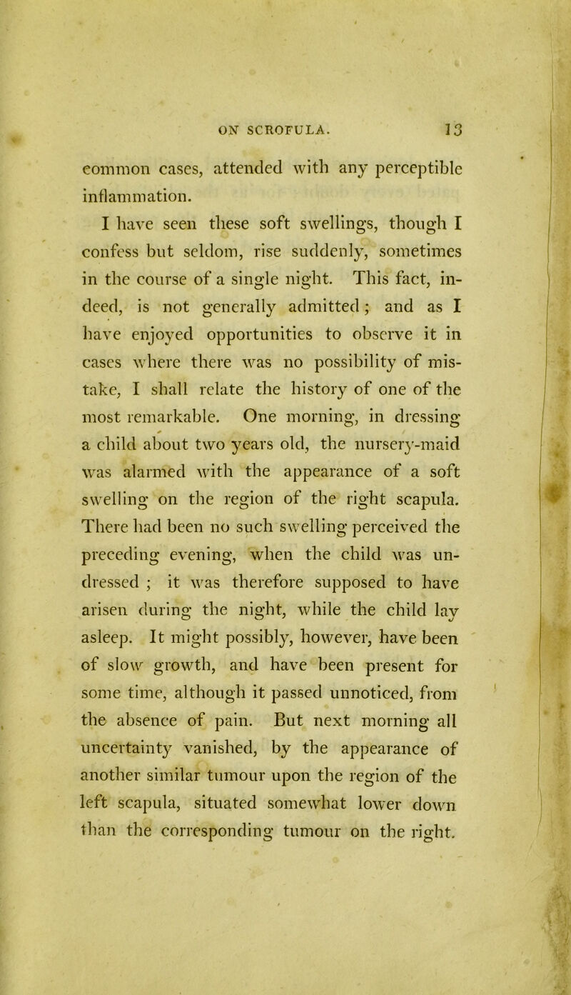 eommon cases, attended with any perceptible inflammation. I have seen these soft swellings, though I confess but seldom, rise suddenly, sometimes in the course of a single night. This fact, in- deed, is not generally admitted; and as I have enjoyed opportunities to observe it in cases where there was no possibility of mis- take, I shall relate the history of one of the most remarkable. One morning, in dressing a child about two years old, the nursei’3-maid was alarmed Avith the appearance of a soft swelling on the region of the right scapula. There had been no such swelling perceived the preceding evening, when the child was un- dressed ; it was therefore supposed to have arisen during the night, while the child lay asleep. It might possibly, however, have been of slow growth, and have been present for some time, although it passed unnoticed, from the absence of pain. But next morning all uncertainty vanished, by the appearance of another similar tumour upon the region of the left scapula, situated somewhat lower down than the corresponding tumour on the right.