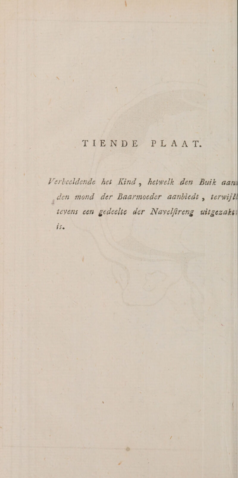 STVENDE PLAAT. Verbeeldende het Kind , hetwelk den Buik aa den mond der Baarmoeder aanbiedt , terwijl tevens een gedeelte der Navelftreng uitgezakit ÍSe