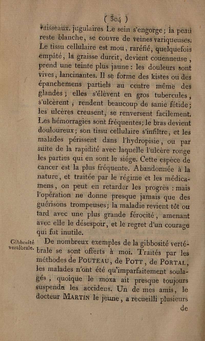 Gibbosité vertébrale. | 2e 0884 7 faisseaux. jugulaires Le sein s’engofse ; la peau reste blanche, se couvre de veines variqueusés: Le tissu cellulaire est mou, raréfié, quelquefois empâté, là graisse durcit, devient couennese $ prend une teinte plüs jaune : les douleurs sont vives ; lancinanites. Il se forme des kistes où des épanchemens partiels au centre imémé des glandes ; elles s'élèvent en gros tubercules , s’ulcèrent ; rendent beaucoup de sanie fétide : les ulcères creusent, se renversent facilement. Les hémorragies sont fréquentes; le bras devient douloureux; son tissu cellulaire sinfiltre, et les malades périssent dans l'hydropisie, où par suite de la rapidité avec laquelle l'ulcère ronge es parties qui en sont le siése. Cette espèce de cancer est la plus fréquente. A bandonnée à la nature, et traitée par le régime et les médica- mens, on peut en retarder les progrès : mais l'opération ne donne presque jamais que des guérisons trompeuses; la maladie revient tôt ou tard avec une plus grande férocité, amenant avec elle le désespoir, et le regret d’un courage qui fut inutile. De nombreux exemples de la gibbosité vertés bralé se sont offerts à moi. Traités par les méthodes de POUTEAU, de PoTT , de PORTAL, les malades n’ont été qu'imparfaitement soula- és ; quoique le moxa ait presque toujours suspendu les accidens. Un de mes amis, le docteur MARTIN le jeune, a recueilli plusieurs rue