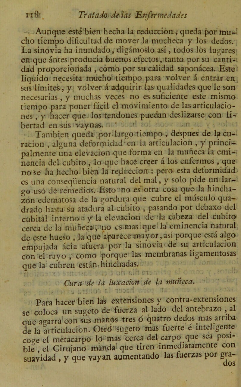 n S' Tratado dedas Mnfermedades Aunque este bien hecha la reduccion * queda por mu- cho tiempo dificultad de mover la mucheca y los dedos. La sinovia ha inundado, digamo6lo, asi, todos los lugares en que antes producia buenos efectos, tanto por su canti- dad proporcionada , cbmo por su calidad saponacea. Este liquido necesita mucho1 tiempo para volver a entrar en sus limites , y volver a adquirir las qualidades que le son necesarias , y muchas veces no es suficiente este mismo tiempo para poner facil el movimiento de lasarticulacio- nes, y hacer que los tendones puedan deslizarse con li» bertad en sus vaynas. ' art Tambien queda por largo tiempo , despues de la cu- racion , alguna deformidad-en la articulacion , y princi- palmente una elevacion que forma en la muheca la emi- nencia del cubito , -lo que hace creer a los enfermos , que no se ha hecho bien la reduccion : pero esta deformidad^ es una conseqtiencia natural del mal, y solo pide uri lar- go uso de remedies. EstD no es otra cosa que la hincha- zon edematosa de la gordura que cubre el musculo qua- drado hasta su atadura al cubito , pasando por debaxo del cubital interno :1 y la elevacion de la cabe-za del cubito cerca de la mune'ca^, no es mas qpe la'eminencia natural de este hueso , la que aparece mayor,asi porque esta algo empujada acia afuera por la sinovia de su articulacion con el rayo , corno porque las membranas ligamentosas que la cubren estan-hindhadas. r- • oh »;Ift BIS v •. Cura'de la luxation de la uuineca. . . .4 r • , •>'. < 1 f J • *• l.I ‘ 1 ' I ti ■ ' 11 Para hacer bien las extensiones y contra-extensiones se coloca un sugeto de fuerza al lado del antebrazo , al cue ao-arra con sus manos tres o quatro dedos mas arriba de la articulacion. Otrd Sugeto mas fuerte e inteligente cogeel metacarpo lo mas cerca del.carpo que sea posi- ble , el Girujano manda que tiren inmediatamente con suavidad , y que vayan aumentando las fuerzas por gra-