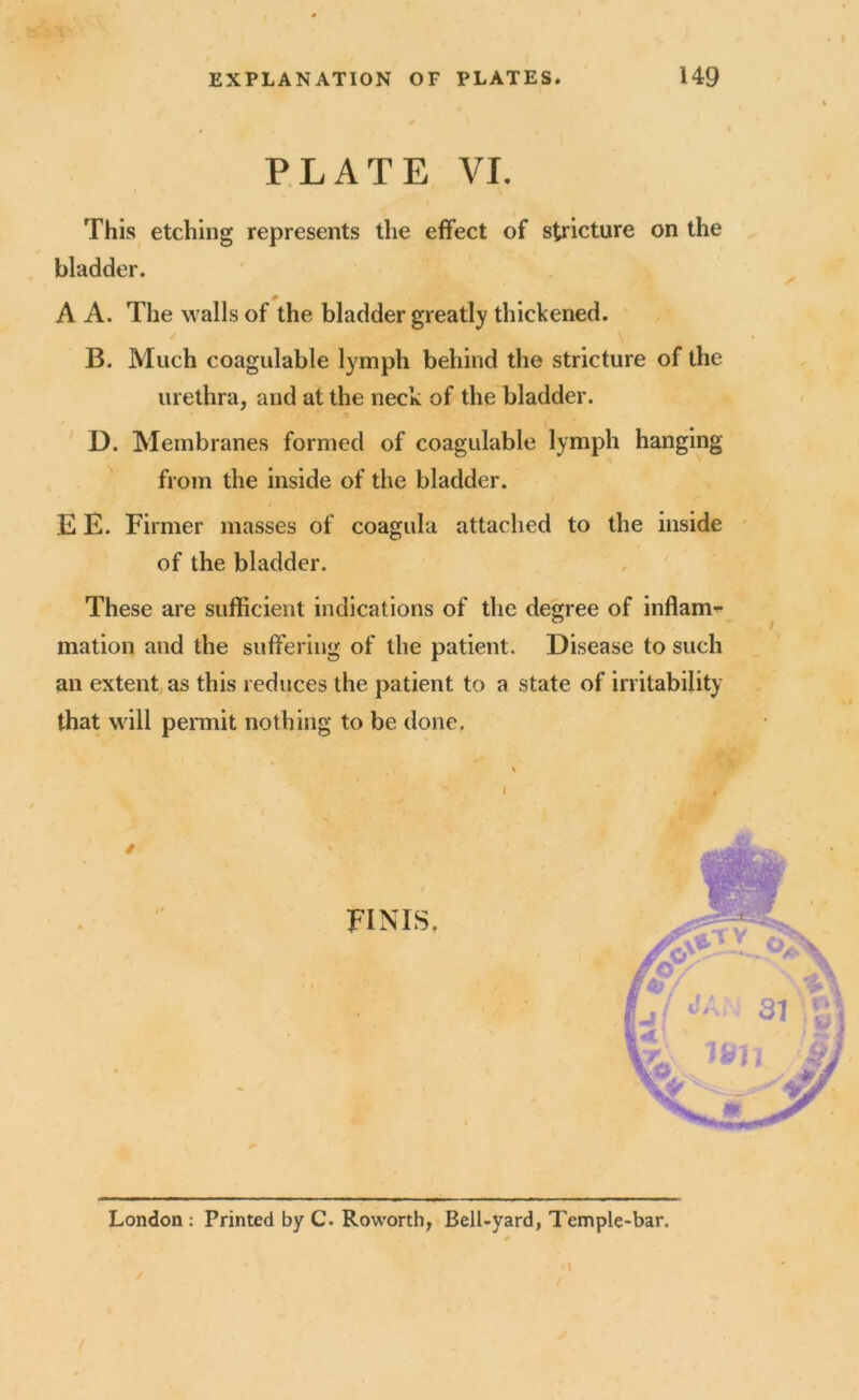 PLATE VI. This etching represents the effect of stricture on the bladder. 0 A A. The walls of the bladder greatly thickened. B. Much coagulable lymph behind the stricture of the urethra, and at the neck of the bladder. D. Membranes formed of coagulable lymph hanging from the inside of the bladder. E E. Firmer masses of coagula attached to the inside of the bladder. These are sufficient indications of the degree of inflam- mation and the suffering of the patient. Disease to such an extent as this reduces the patient to a state of irritability that will permit nothing to be done. / FINIS. London : Printed by C- Roworth, Bell-yard, Temple-bar.