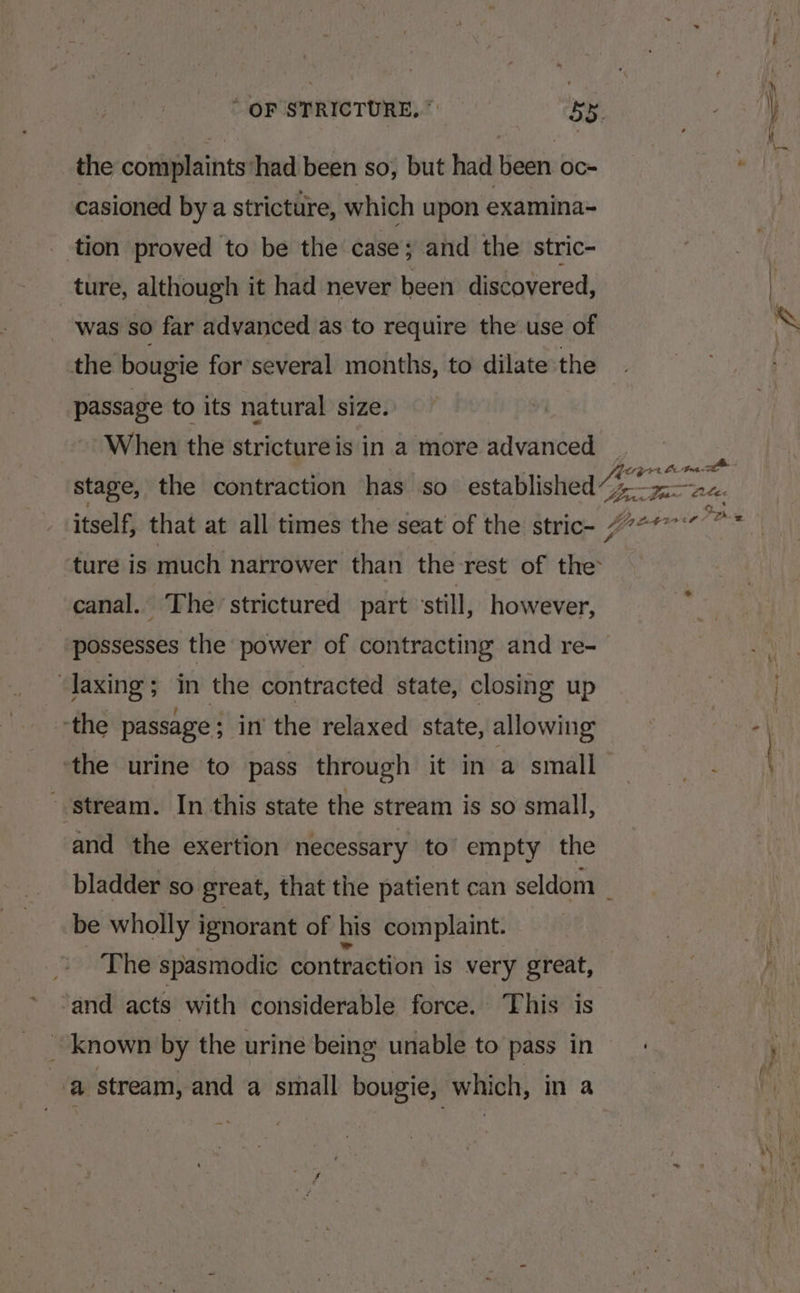 the complaints ‘had been so, but had been oc- casioned by a stricture, which upon examina= tion proved to be the case; and the stric- ture, although it had never been discovered, : was so far advanced as to require the use of the bougie for several months, to dilate the passage to its natural size. When the stricture is in a more advanced erg rt Le a canal. The strictured part ‘still, however, possesses the power of contracting and re- ‘laxing; in the contracted state, closing up -the passage ; in the relaxed state, allowing ‘the urine to pass through it in a small “stream. In this state the stream is so small, and the exertion necessary to’ empty the be wholly ignorant of his complaint. The spasmodic contraction is very great, and acts with considerable force. ‘This is ~ known by the urine being unable to pass in a stream, and a small bougie, which, in a