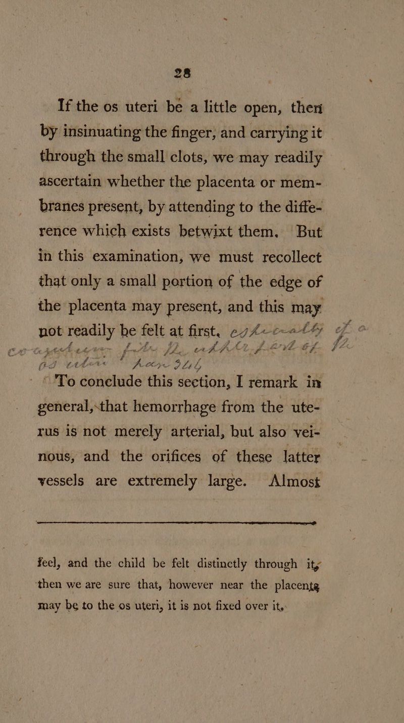 If the os uteri be a little open, ther by insinuating the finger, and carrying it through the small clots, we may readily ascertain whether the placenta or mem- branes present, by attending to the diffe- rence which exists betwixt them, But in this examination, we must recollect that only a small portion of the edge of the placenta may present, and on may Paty Ee of fi a f Le Ahi a Pr oe ee (ea Puke. t« ELS PLeb ~ 'To conelude this section, LT remark in ay ery he felt at first, egh<e~ cual ty general,.that hemorrhage from the ute- rus is not merely arterial, but also vei- nous, and the orifices of these latter vessels are extremely large. Almost feel, and the child be felt distinctly through ity ‘then we are sure that, however near the placente may be to the os uteri, it is not fixed over it: