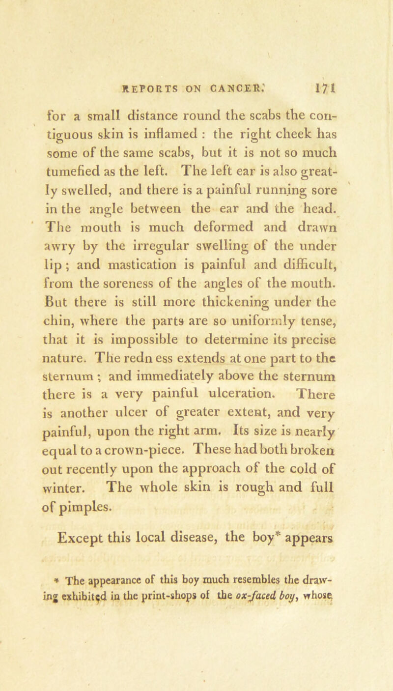 for a small distance round the scabs the con- tiguous skin is inflamed : the right cheek has some of the same scabs, but it is not so much tumefied as the left. The left ear is also great- ly swelled, and there is a painful running sore in the angle between the ear and the head. The mouth is much deformed and drawn awry by the irregular swelling of the under lip; and mastication is painful and difficult, from the soreness of the angles of the mouth. But there is still more thickening under the chin, where the parts are so uniformly tense, that it is impossible to determine its precise nature. The redness extends atone part to the sternum ; and immediately above the sternum there is a very painful ulceration. There is another ulcer of greater extent, and very painful, upon the right arm. Its size is nearly equal to a crown-piece. These had both broken out recently upon the approach of the cold of winter. The whole skin is rough and full of pimples. Except this local disease, the boy* appears * The appearance of this boy much resembles the draw- ing exhibited in the print-shops of the ox-/aced boy, whose