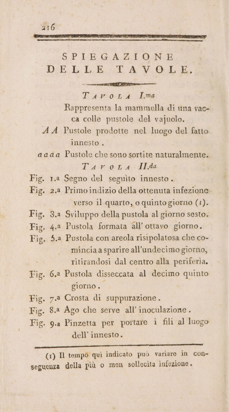 RIT III RAS MTTIPE COSTE IRAN IIRII PIERI SPIEGAZIONE DELLE TAVOLE, TAVOLA Ima Rappresenta la mammella di una vac- ca colle pustole del vajuolo. AA Pustole prodotte nel luogo del fatto innesto . aaaa Pustole che sono sortite naturalmente. Tavora Ilda Fig. 1.a Segno del seguìto innesto . Fig. 2.23 Primoindizio della ottenuta infezione verso il quarto, o quinto giorno (1). Fig. 3.2 Sviluppo della pustola al giorno sesto. Fig. 4.2 Pustola formata all'ottavo giorno. Fig. 5.a Pustola con areola risipolatosa che co- minciaa sparire all’undecimo giorno, ritirandosi dal centro alla periferìa. Fig. 6.2 Pustola disseccata al decimo quinto giorno . Fig. 7.8 Crosta di suppurazione . Fig. 8.2 Ago che serve all’ inoculazione . Fig. 9.a Pinzetta per portare i fili al luogo dell’ innesto. RO e sl (1) Il tempo quì indicato può variare in Cone seguenza della più o mon sollecita infezione +