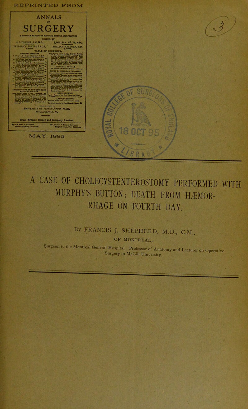 REPRINTED FROM ANNALS SURGERY EDITH) B V C 1 MLCMM. A.K. M.O. ' Jl WILLIAM WttlTl. MD4 MEPIUKK THVQ.PK.C3, WILLIAM MACkWKX. KP; HTKNTt* I NNKll < i A CASE OF CHOLECYSTENTEROSTOMY PERFORMED WITH MURPHY'S BUTTON; DEATH FROM HEMOR- RHAGE ON FOURTH DAY. By FRANCIS J. SHEPHERD, M.D., C.M., OF MONTREAL, Surgeon ,o the Montreal General Hospital; Professor of Anatomy and Lecturer on Operative Surgery in McGill University.