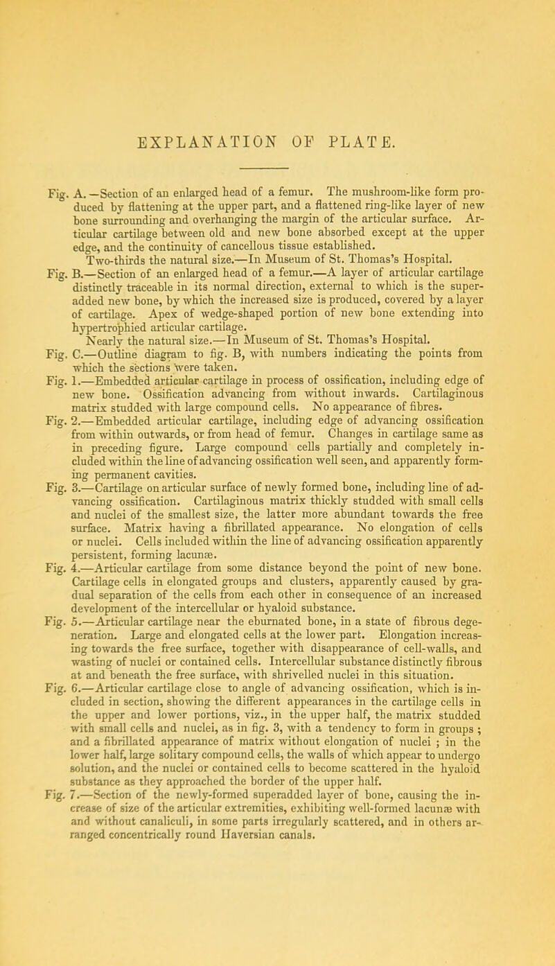 Fig. A. —Section of an enlarged head of a femur. The mushroom-like form pro- duced by flattening at the upper part, and a flattened ring-like layer of new bone surrounding and overhanging the margin of the articular surface. Ar- ticular cartilage between old and new bone absorbed except at the upper edge, and the continuity of cancellous tissue established. Two-thirds the natural size.—In Museum of St. Thomas's Hospital. Fig. B.—Section of an enlarged head of a femur A layer of articular cartilage distinctly traceable in its normal direction, external to which is the super- added new bone, by which the increased size is produced, covered by a layer of cartilage. Apex of wedge-shaped portion of new bone extending into hypertrophied articular cartilage. Nearly the natural size.—In Museum of St. Thomas's Hospital. Fig. C.—Outline diagram to fig. B, with numbers indicating the points from which the sections were taken. Fig. 1.—Embedded articular cartilage in process of ossification, including edge of new bone. Ossification advancing from without inwards. Cartilaginous matrix studded with large compound cells. No appearance of fibres. Fig. 2.—Embedded articular cartilage, including edge of advancing ossification from within outwards, or from head of femur. Changes in cartilage same as in preceding figure. Large compound cells partially and completely in- cluded within the line of advancing ossification well 6een, and apparently form- ing permanent cavities. Fig. 3.—Cartilage on articular surface of newly formed bone, including line of ad- vancing ossification. Cartilaginous matrix thickly studded with small cells and nuclei of the smallest size, the latter more abundant towards the free surface. Matrix having a fibrillated appearance. No elongation of cells or nuclei. Cells included within the line of advancing ossification apparently persistent, forming lacunas. Fig. 4.—Articular cartilage from some distance beyond the point of new bone. Cartilage cells in elongated groups and clusters, apparently caused by gra- dual separation of the cells from each other in consequence of an increased development of the intercellular or hyaloid substance. Fig. 5.—Articular cartilage near the eburnated bone, in a state of fibrous dege- neration. Large and elongated cells at the lower part. Elongation increas- ing towards the free surface, together with disappearance of cell-walls, and wasting of nuclei or contained cells. Intercellular substance distinctly fibrous at and beneath the free surface, with shrivelled nuclei in this situation. Fig. 6.—Articular cartilage close to angle of advancing ossification, which is in- cluded in section, showing the different appearances in the cartilage cells in the upper and lower portions, viz., in the upper half, the matrix studded with small cells and nuclei, as in fig. 3, with a tendency to form in groups ; and a fibrillated appearance of matrix without elongation of nuclei ; in the lower half, large solitary compound cells, the walls of which appear to undergo solution, and the nuclei or contained cells to become scattered in the hyaloid substance as they approached the border of the upper half. Fig. 7.—Section of the newly-formed superadded layer of bone, causing the in- crease of size of the articular extremities, exhibiting well-formed lacunae with and without canaliculi, in some parts irregularly scattered, and in others ar- ranged concentrically round Haversian canals.