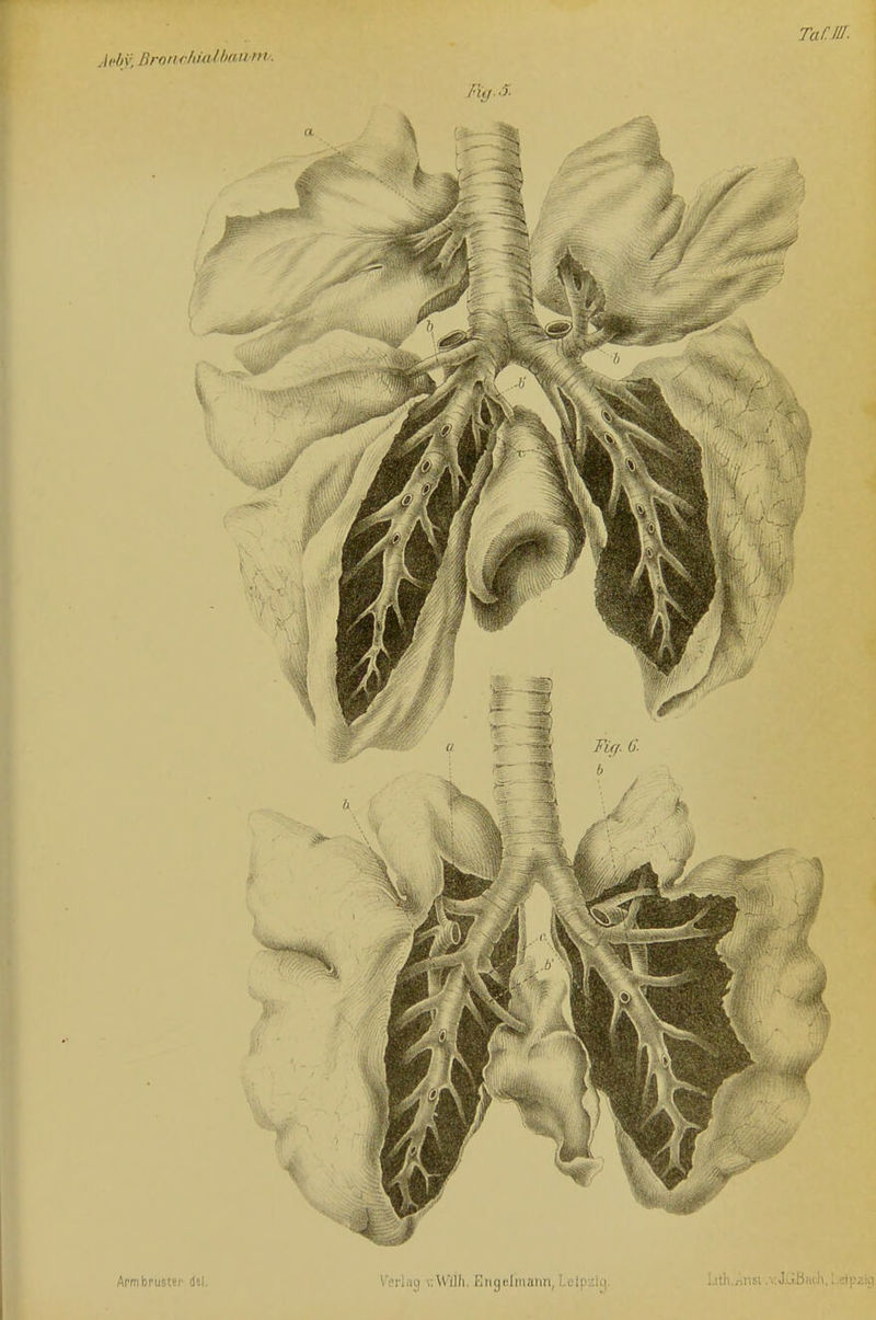 TaClü. .\i-hy. Brnnckmlhawni.