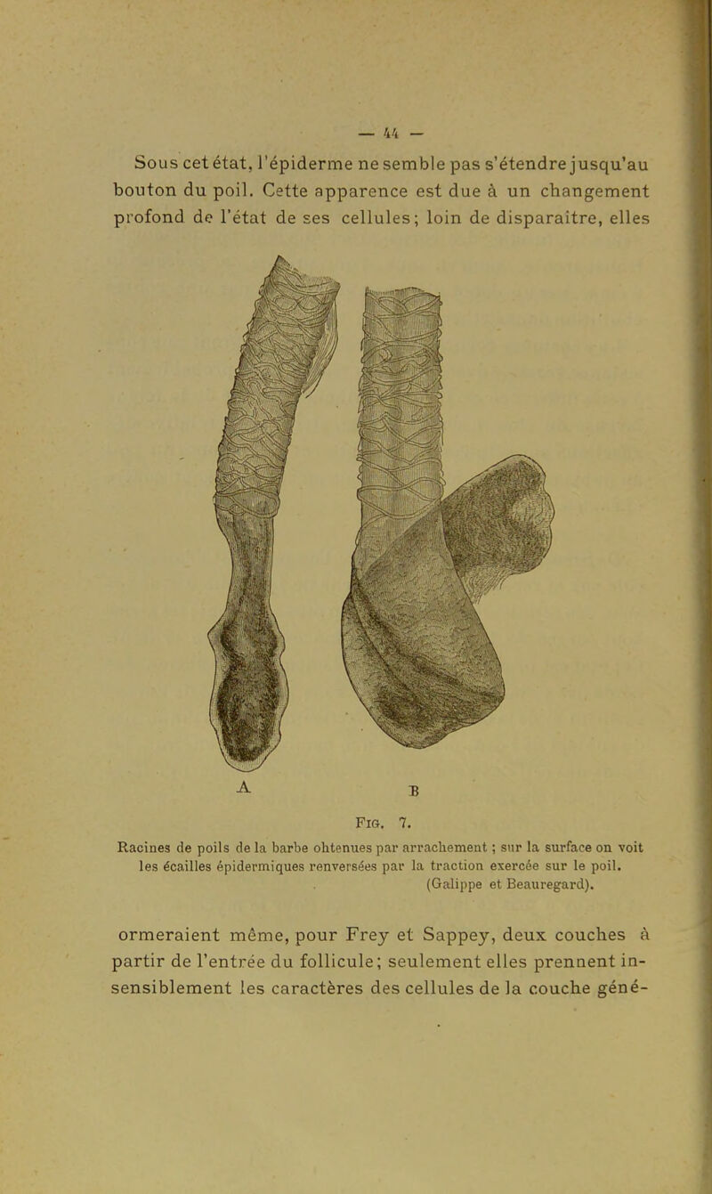 Sous cet état, l'épiderme ne semble pas s'étendre jusqu'au bouton du poil. Cette apparence est due à un changement profond de l'état de ses cellules; loin de disparaître, elles A B FiG. 7. Racines de poils de la barbe obtenues par arrachement ; sur la surface on voit les écailles épidermiques renversées par la traction exercée sur le poil. (Galippe et Beauregard). ormeraient même, pour Frey et Sappey, deux couches à partir de l'entrée du follicule; seulement elles prennent in- sensiblement les caractères des cellules de la couche géné-