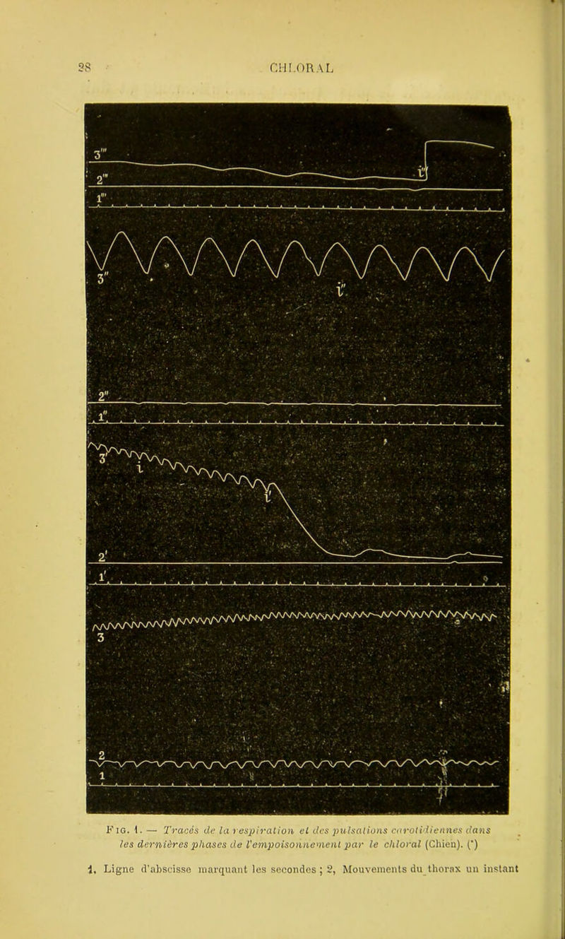 CHI.OR AL Fig. 1. — Tracés du la respiration cl des pulsations carotidiennes dans les dernières phases de l'empoisonnement par le chloral (Chien). (') i, Ligne d'abscisse marquant les secondes ; 2, Mouvements du thorax un instant