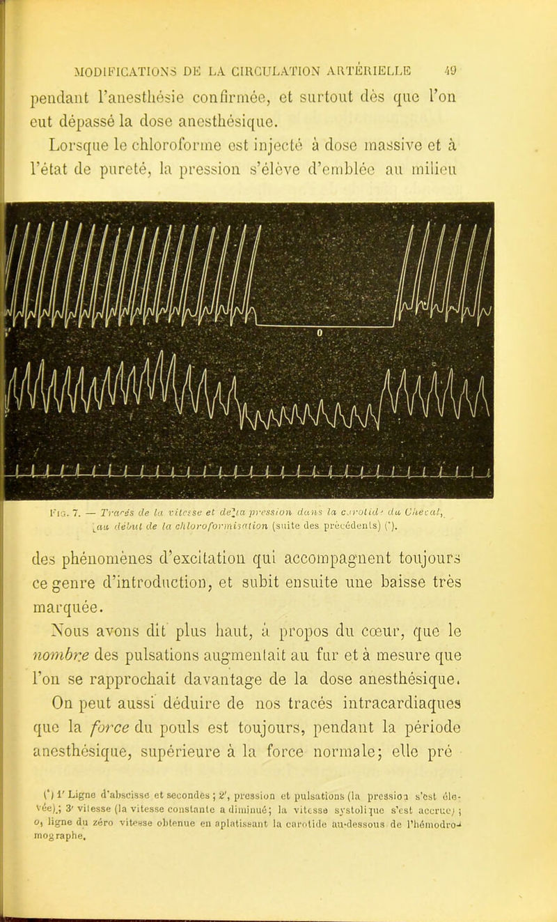 pendant l’anesthésie confirmée, et surtout dès que l’on eut dépassé la dose anesthésique. Lorsque le chloroforme ost injecté à dose massive et à l’état de pureté, la pression s’élève d’emblée au milieu Fig. 7. — Tracés de la vitesse et délia pression dans la cjrolidt du Cliecal, Lnu début de la chloroformisation (suite des précédents) ('). des phénomènes d’excitation qui accompagnent toujours ce genre d’introduction, et subit ensuite une baisse très marquée. Nous avons dit plus haut, à propos du coeur, que le nombre des pulsations augmentait au fur et à mesure que l’on se rapprochait davantage de la dose anesthésique. On peut aussi déduire de nos tracés intracardiaques que la force du pouls est toujours, pendant la période anesthésique, supérieure à la force normale; elle pré [') V Ligne d’abscisse et secondes ; 2\ pression et pulsations (la pression s'est élo- vée)_; 3'vil esse (la vitesse constante a diminué; la vitesse systolique s’est accrue-; ; O, ligne du zéro vitesse obtenue en aplatissant la carotide au-dessous de l’hémodro-* mographe.