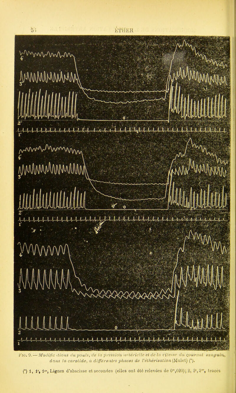 Cv KTllEH KlO. 9. — Modifia liions du ponts, do la pression artérielle et de la vitesse du courant sanguin, d'ins la carotide, à différantes phases do l'éthérisation (Mulet) (').