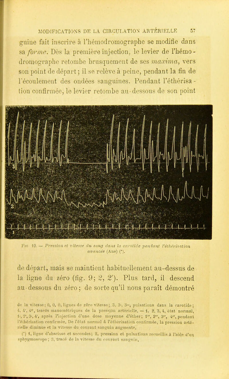 guine fait inscrire à l’hémodromographe se modifie dans sa forme. Dès la première injection, le levier de l’hémo- dromographo retombe brusquement de ses maxima, vers son point de départ ; il se relève à peine, pendant la fin de l'écoulement des ondées sanguines. Pendant Péthérisa - tion confirmée, le levier retombe au-dessous de son point l’in 10. — Pression et vitesse du sang dans la carotide pendant Véthérisation avancée (Ane) (*). de départ, mais se maintient habituellement au-dessus de la ligne du zéro (fig. 9; 2, 2'). Plus tard, il descend au-dessous du zéro; de sorte qu’il nous paraît démontré de la vitesse; 0, 0, 0, lignes de zéro vitesse; 3, 3', 3, pulsations dans la carotide; 4, 4’, 4, tracés manométriques de la pression artérielle. — 1, 2, 3, 4, état normal, 1-, 2', 3», 4', après l’injection d’une dose moyenne d’éther; 1, S, 3, 4, pendant l’éthérisation confirmée. De l’état normal à l’éthérisation confirmée, la pression arté- rielle diminue et la vitesse du courant sanguin augmente. C) 1, ligne d’abscisse et secondes; 2, pression et pulsations recueillis à l’aide d’un sphygmoscope ; 3, tracé de la vitesse du courant sanguin,