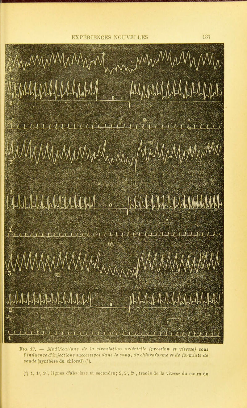 ■ EXPERIENCES NOUVELLES Fig. i2. — Modifications de la circulation artérielle (pression et vitesse) sous l’influence d'injections successives dans le sang, de chloroforme et de formiate de soude (synthèse du chloral) (’). (*) (*) 1, 1', i, lignes d’ahsi isse et secondes; 2, 2', 2, tracés de la vitesse du cours du