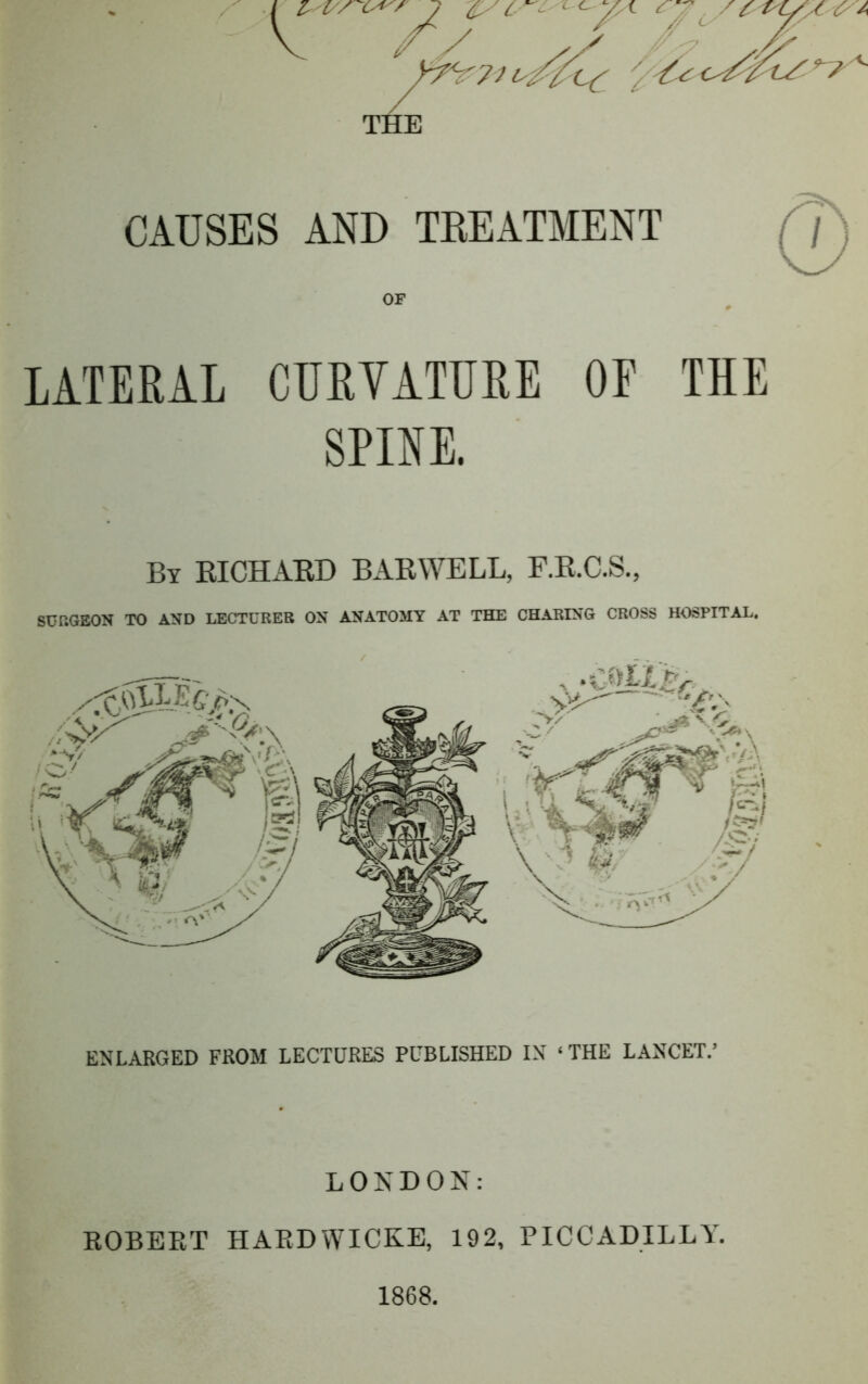 CAUSES AND TREATMENT (f) OF LATERAL CURVATURE OF THE SPINE. By RICHARD BARWELL, F.R.C.S., SURGEON TO AND LECTURER ON ANATOMY AT THE CHARING CROSS HOSPITAL. ENLARGED FROM LECTURES PUBLISHED IN ‘ THE LANCET.’ LONDON: ROBERT HARDWICKE, 192, PICCADILLY. 1868.