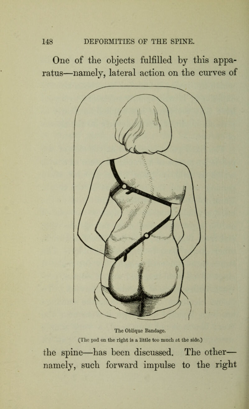 One of the objects fulfilled by this appa- ratus—namely, lateral action on the curves of the spine—has been discussed. The other— namely, such forward impulse to the right