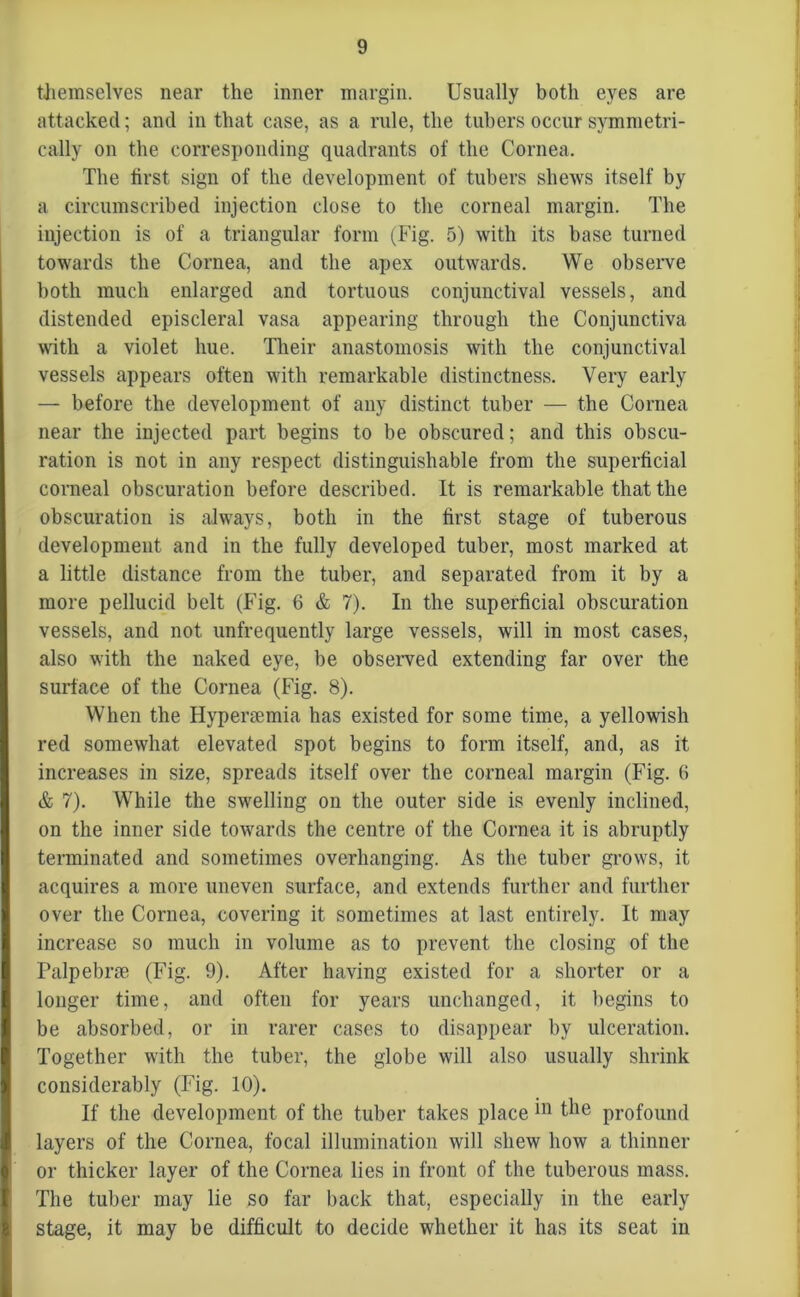 themselves near the inner margin. Usually both eyes are attacked; and in that case, as a rule, the tubers occur symmetri- cally on the corresponding quadrants of the Cornea. The first sign of the development of tubers shews itself by a circumscribed injection close to the corneal margin. The injection is of a triangular form (Fig. 5) with its base turned towards the Cornea, and the apex outwards. We observe both much enlarged and tortuous conjunctival vessels, and distended episcleral vasa appearing through the Conjunctiva with a violet hue. Their anastomosis with the conjunctival vessels appears often with remarkable distinctness. Very early — before the development of any distinct tuber — the Cornea near the injected part begins to be obscured; and this obscu- ration is not in any respect distinguishable from the superficial corneal obscuration before described. It is remarkable that the obscuration is always, both in the first stage of tuberous development and in the fully developed tuber, most marked at a little distance from the tuber, and separated from it by a more pellucid belt (Fig. 6 & 7). In the superficial obscuration vessels, and not unfrequently large vessels, will in most cases, also with the naked eye, be observed extending far over the surface of the Cornea (Fig. 8). When the Hypermmia has existed for some time, a yellowish red somewhat elevated spot begins to form itself, and, as it increases in size, spreads itself over the corneal margin (Fig. 6 & 7). While the swelling on the outer side is evenly inclined, on the inner side towards the centre of the Cornea it is abruptly terminated and sometimes overhanging. As the tuber grows, it acquires a more uneven surface, and extends further and further over the Cornea, covering it sometimes at last entirely. It may increase so much in volume as to prevent the closing of the Palpebne (Fig. 9). After having existed for a shorter or a longer time, and often for years unchanged, it begins to be absorbed, or in rarer cases to disappear by ulceration. Together with the tuber, the globe will also usually shrink considerably (Fig. 10). If the development of the tuber takes place profound layers of the Cornea, focal illumination will shew how a thinner or thicker layer of the Cornea lies in front of the tuberous mass. The tuber may lie so far back that, especially in the early stage, it may be difficult to decide whether it has its seat in