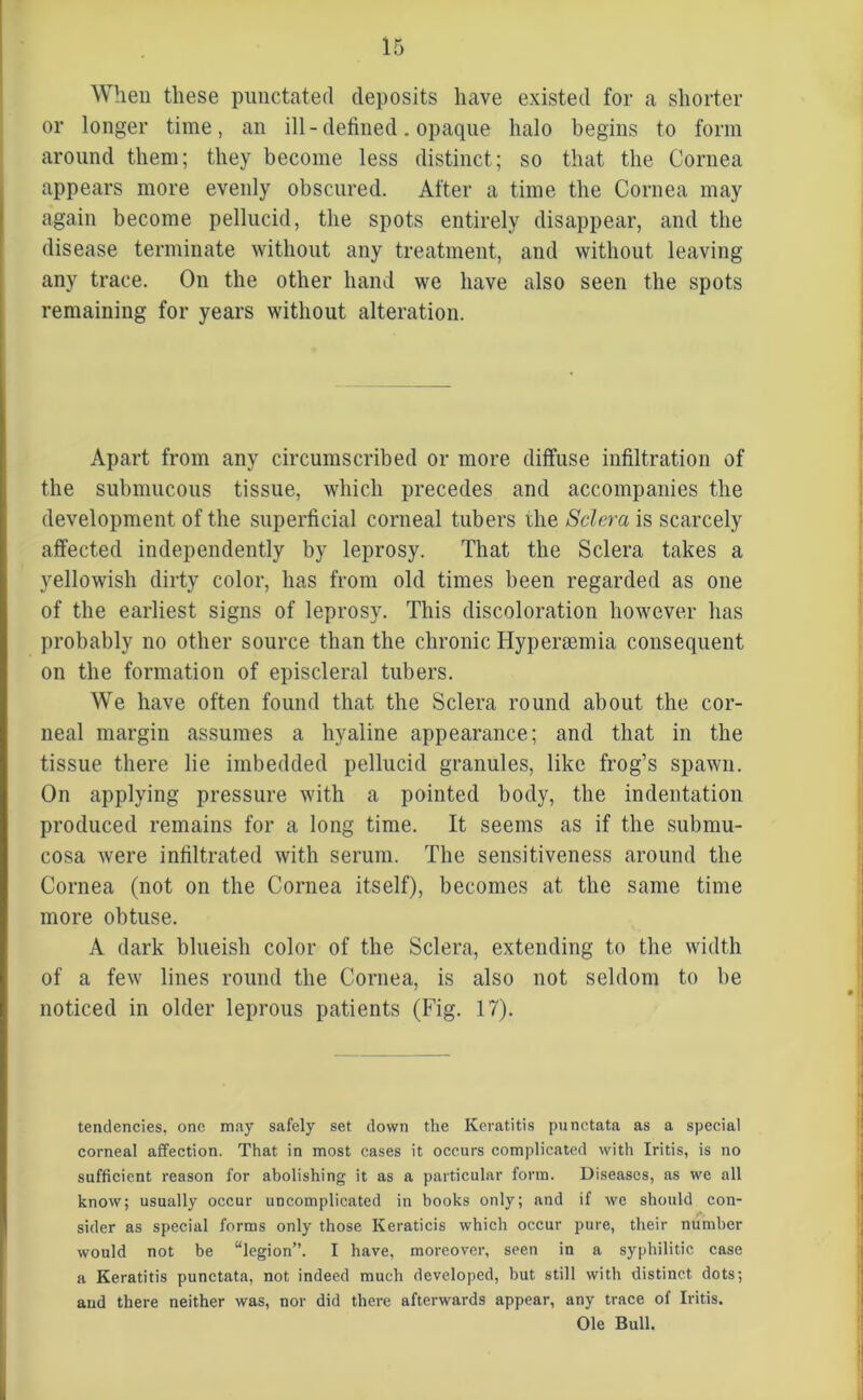 When these punctated deposits have existed for a shorter or longer time, an ill- defined. opaque halo begins to form around them; they become less distinct; so that the Cornea appears more evenly obscured. After a time the Cornea may again become pellucid, the spots entirely disappear, and the disease terminate without any treatment, and without leaving any trace. On the other hand we have also seen the spots remaining for years without alteration. Apart from any circumscribed or more diffuse infiltration of the submucous tissue, which precedes and accompanies the development of the superficial corneal tubers the Sclera is scarcely affected independently by leprosy. That the Sclera takes a yellowish dirty color, has from old times been regarded as one of the earliest signs of leprosy. This discoloration however has probably no other source than the chronic Hypersemia consequent on the formation of episcleral tubers. We have often found that the Sclera round about the cor- neal margin assumes a hyaline appearance; and that in the tissue there lie imbedded pellucid granules, like frog’s spawn. On applying pressure with a pointed body, the indentation produced remains for a long time. It seems as if the submu- cosa were infiltrated with serum. The sensitiveness around the Cornea (not on the Cornea itself), becomes at the same time more obtuse. A dark blueish color of the Sclera, extending to the width of a few lines round the Cornea, is also not seldom to be noticed in older leprous patients (Fig. 17). tendencies, one may safely set down the Keratitis punctata as a special corneal affection. That in most cases it occurs complicated with Iritis, is no sufficient reason for abolishing it as a particular form. Diseases, as we all know; usually occur uncomplicated in hooks only; and if we should con- sider as special forms only those Keraticis which occur pure, their number would not he “legion”. I have, moreover, seen in a syphilitic case a Keratitis punctata, not indeed much developed, but still with distinct dots; and there neither was, nor did there afterwards appear, any trace of Iritis. Ole Bull.
