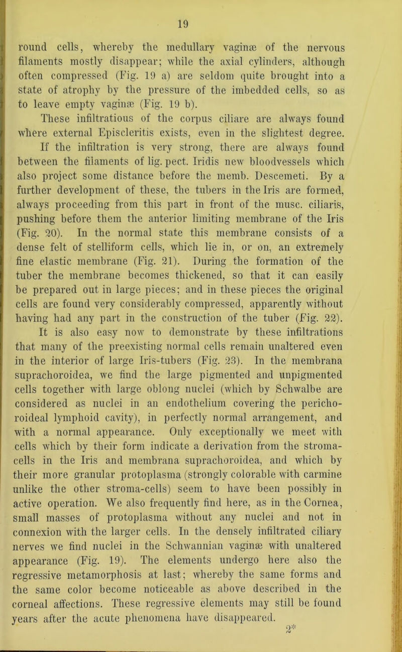 round cells, whereby the medullary vaginae of the nervous filaments mostly disappear; while the axial cylinders, although often compressed (Fig. 19 a) are seldom quite brought into a state of atrophy by the pressure of the imbedded cells, so as to leave empty vaginae (Fig. 19 b). These infiltrations of the corpus ciliare are always found where external Episcleritis exists, even in the slightest degree. If the infiltration is very strong, there are always found between the filaments of lig. pect. Iridis new bloodvessels which also project some distance before the memb. Descemeti. By a further development of these, the tubers in the Iris are formed, always proceeding from this part in front of the muse, ciliaris, pushing before them the anterior limiting membrane of the Iris (Fig. 20). In the normal state this membrane consists of a dense felt of stelliform cells, which lie in, or on, an extremely fine elastic membrane (Fig. 21). During the formation of the tuber the membrane becomes thickened, so that it can easily be prepared out in large pieces; and in these pieces the original cells are found very considerably compressed, apparently without having had any part in the construction of the tuber (Fig. 22). It is also easy now to demonstrate by these infiltrations that many of the preexisting normal cells remain unaltered even in the interior of large Iris-tubers (Fig. 23). In the membrana suprachoroidea, we find the large pigmented and unpigmented cells together with large oblong nuclei (which by Schwalbe are considered as nuclei in an endothelium covering the pericho- roideal lymphoid cavity), in perfectly normal arrangement, and with a normal appearance. Only exceptionally we meet with cells which by their form indicate a derivation from the stroma- cells in the Iris and membrana suprachoroidea, and which by their more granular protoplasma (strongly colorable with carmine unlike the other stroma-cells) seem to have been possibly in active operation. We also frequently find here, as in the Cornea, small masses of protoplasma without any nuclei and not in connexion with the larger cells. In the densely infiltrated ciliary nerves we find nuclei in the Schwannian vaginae with unaltered appearance (Fig. 19). The elements undergo here also the regressive metamorphosis at last; whereby the same forms and the same color become noticeable as above described in the corneal affections. These regressive elements may still be found years after the acute phenomena have disappeared.