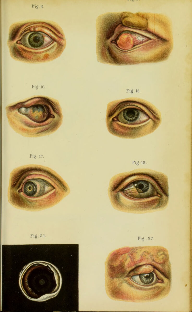 Fig. 8. Fig. 24. Fig'. 16. Fig.18. Fig .27. Fig. 17.