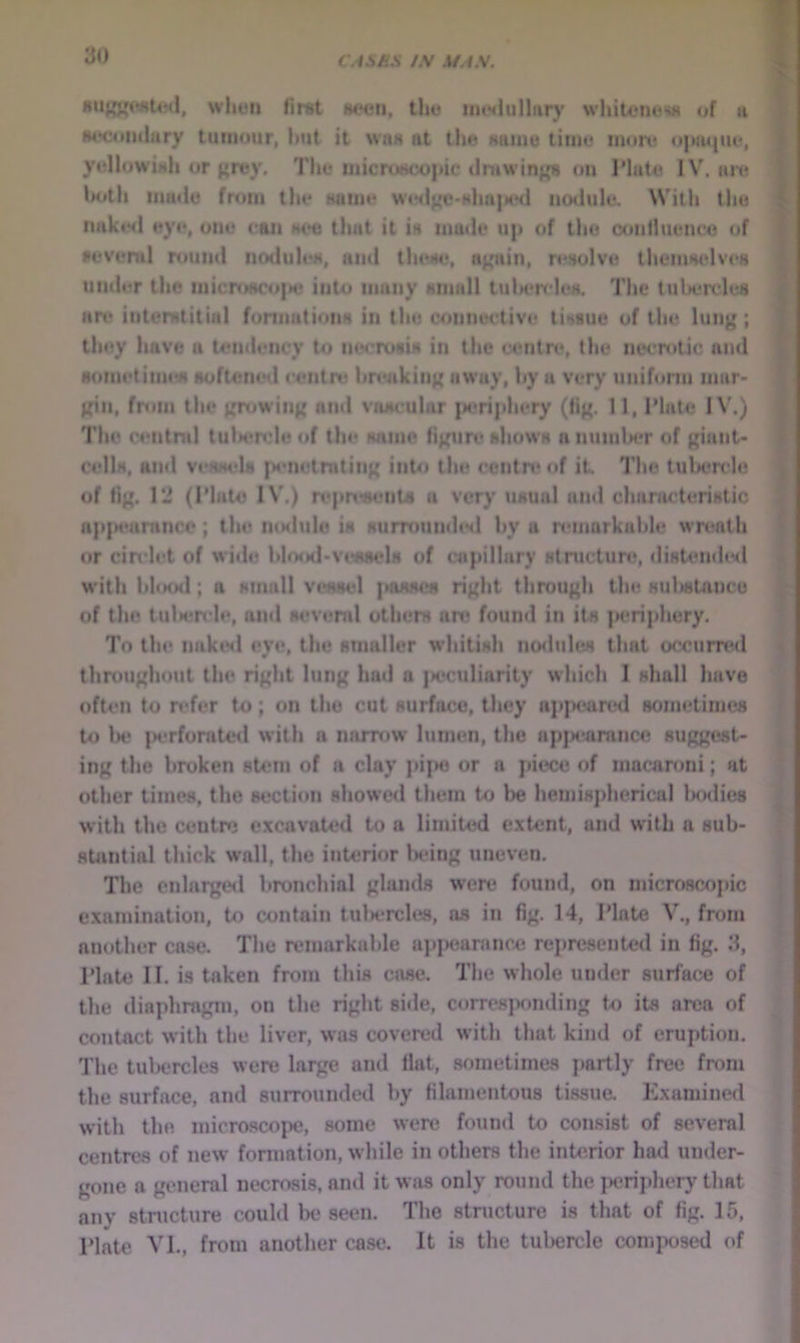 wliLMi first HtHJii, tlio iii(yiulltir)’ whitom*'^ of a stHroiuiary tumour, l»ut it wiim at the Maine time iimre o|HU|tie, yellowiali or f*rey. The microscopic drawinjj;s on I’late IV. im* both made from the Hume W(*<i^c-Mha|MMl nodule. With the naktMl eye, one can see that it is ma»le up of the confluence of •evend round nodules, and thestj, apiin, n*solve themselv(‘s under the microMCo|>e into many Mtiiali tulK'tvles, The tuliercles art* iiiterHtitiul formations in the connective tissue of the lun^ ; they have a U*ndcncy to necrosis in the contn*, the iu*crotic and sometinnst softencHl centre hreakin({ away, by a very unihirm mar- jfiti. from the {frowin^ and vascular |»eriphery (tij(. 11, Tlate IV.) The ctmtnil tulM*rcle of the same fij^iit* shows a numlM*r of {^iant* cells, and vesstds [M*netratiii){ into the ccntn* of it 1'he tul>ertde of ti{{. 12 (Plato I\'.) rt*pn<«ents a very usual and characteristic ap|M*antnce; the mslule is suirounded by a remarkable wrt*nlh or circlet of wide IiUmmI*vessels of capillary stnicture, diKUmd(*<l w'ith blood; a small vessel ]>asst!s rit'ht through the sulistancu of the tulien le, ami several others are found in its latriphery. To the nakt*d eye, the smaller wdiitish no<lules that occurred throughout the right lung had a }H*culiarity which I shall have often to refer to; on the cut surface, they appeartal sometimes to lx* jK'rfomted with a narrow lumen, the npjK*arancc suggest- ing the broken stem of a clay pijxi or a piece of macaroni; at other times, the section showc<l them to l)e hemispherical Ixslies with the centre excavated to a limited extent, and w'ith a sub- stantial thick wall, the interior Ix'ing uneven. The cnlargeil bronchial glands were found, on microscopic examination, to contain tulsTcles, ns in fig. 14, I’lnte V., from another case. The remarkable appeaninc.c represented in fig. 3, riak^ II. is taken from this case. The whole under surface of tlie diaphragm, on the right side, corresponding to its area of contact with the liver, was covered with that kind of eruption. The tulxjrcles were large and fiat, sometimes jiartly free from the surface, and surrounded by filamentous tissue. E.xamined with tlie micrascope, some were found to consist of several centres of new fomiation, wliile in others the interior had under- gone a general necrasis, and it was only round the iieriphery tliat any structure could be seen. Tlie structure is that of fig. 15, I’late VI., from another case. It is the tubercle composed of