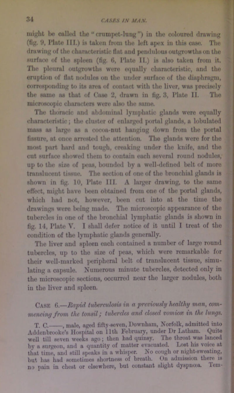 lui^ht bo cttlhHl the “crumpet-lung”) in the c^ilourod drawing M (fig. 9, Hate III.) iit taken from the left aj>ex in thia case. The M drawing of the cliaracteriBlic flat and pendulous outgrtiwllis on lliu ■ Murfaco of the spleen (fig, 6, l*hit4J 11.) is also taken from it. j The pleural outgrowths were e<)ually characteristic, and the eruption of flat msiules on the under surface of the diaphragm, coin.*s|Maiding to its an»a of contact with the liver, was precisely the some ns tliat of Case 2, drawn in fig. 3, Plate II. The micitsioopic chiimcteni w’ere also the snina The thoracic and abdominal lymphatic glamls wore equally « characteristic; the cluster of enlarged {xirtal glands, a lubulate<l imiss as larg«i as a cocoa*nut hanging clown from the {mtrial ' fissuitt, at ont'o am*sled the atU«ntion. The glands were for the ’ most |Mirt linrd and tough, creaking under the knife, and the ' cut surface showed them to contain each several round nodules,- up to the size of |a*as, boumled by a well-defincal belt of more I translucent tissue. The section of one of the bronchial glands is -fe shown in fig. 10, Plate; III. A huger drawing, to the same J ofTec-t, might have lioen obtainecl from one of the portal glands, which had not, however, bc,*cn cut into at the time the drawings were being made. The microscopic apjiearancc of the tul)erch« in one of the bronchial lymphatic glands is shown in fig. 14, Plate V. I shall defer notice of it until I treat of the condition of the lymphatic glands generally. The liver and spleen each conUune<l a numlxjr of large round tulierclea, up to the size of jaias, whicli were remarkable for their well-marke<i peripheral licit of translucent tissue, simu- lating a capsule. Numerous minute tuljercles, detected only in the microscopic sections, occurred near the larger nodules, botli in the liver and spleen. Case 6.—linpid tnberculosvt in a previovdy hmlthy man, com- mencing from the tonoil; tubercles and closed vomicet in the lungs. T. C. , male, agwl fifty-seven, Downham, Norfolk, admitted into *' Addenbrooke’s Hospital on 11th February, under Dr l^tham. Quite well till seven weeks ago; then had quinsy. 1 he throat was lanced by a surgeon, and a quantity of matter evacuated. Lost his voice at that time, ami still spi’aks in a whisjier. No cough or night-sweating, but has had sometimes shortness of breath. On ailmission there is no pain in chest or elsewhere, but constant slight dyspmea. leiii-
