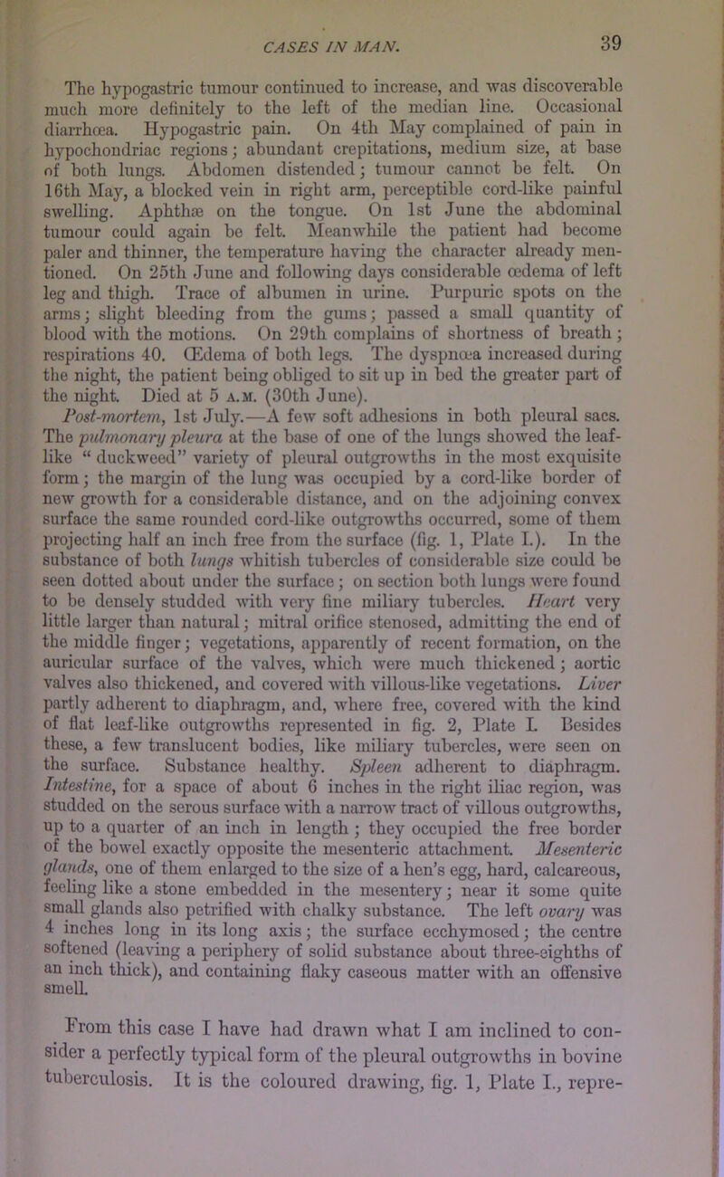 The hypogastric tumour continued to increase, and was discoverahlo much more definitely to the left of the median line. Occasional diarrhoea. Hypogastric pain. On 4th May complained of pain in hypochondriac regions; abundant crepitations, medium size, at base of both lungs. Abdomen distended; tumour cannot be felt. On 16th May, a blocked vein in right arm, perceptible cord-like painful swelling. Aphthae on the tongue. On 1st June the abdominal tumour could again be felt. Meanwhile the patient had become paler and thinner, the temperature having the character already men- tioned. On 25th June and folloNving days considerable oedema of left leg and thigh. Trace of albumen in urine. Purpuric spots on the arms; slight bleeding from the gums; passed a small quantity of blood with the motions. On 29tli complains of shortness of breath ; respirations 40. Oedema of both legs. The dyspna*a increased during the night, the patient being obliged to sit up in bed the greater part of the night. Died at 5 a.m. (30th June). Post-mortem, 1st Jiily.—A few soft adhesions in both pleural sacs. The pulmonarn pleura at the base of one of the lungs showed the leaf- like “ duckweed” variety of pleural outgrowths in the most exquisite form; the margin of the lung was occupied by a cord-like border of new growth for a considerable distance, and on the adjoining convex surface the same rounded cord-like outgrowths occurred, some of them projecting half an inch free from the surface (fig. 1, Plate I.). In the substance of both lungs Avhitish tubercles of considerable size could be seen dotted about under the surface; on section both lungs were found to bo densely studded with very fine miliary tubercles. Heart very little larger than natural; mitral orifice stenosed, admitting the end of the middle finger; vegetations, apparently of recent formation, on the auricular surface of the valves, which were much thickened; aortic valves also thickened, and covered with villous-like vegetations. Liver partly adherent to diaphragm, and, where free, covered with the kind of flat leaf-like outgrowths represented in fig. 2, Plate L Besides these, a few translucent bodies, like miliary tubercles, were seen on the surface. Substance healthy. Spleen adherent to diaphragm. Intestine, for a space of about 6 inches in the right iliac region, was studded on the serous surface with a narroAv tract of villous outgrowths, up to a quarter of an inch in length ; they occupied the free border of the bowel exactly opposite the mesenteric attachment. Mesenteric glands, one of them enlarged to the size of a hen’s egg, hard, calcareous, feeling like a stone embedded in the mesentery; near it some quite small glands also petrified with chalky substance. The left ovary was 4 inches long in its long axis; the surface ecchymosed; the centre softened (leaving a periphery of solid substance about three-eighths of an inch thick), and containing flaky caseous matter with an offensive smell 1 rom this case I have had drawn what I am inclined to con- sider a perfectly typical form of the pleural outgrowths in bovine tuberculosis. It is the coloured drawing, lig. 1, Plate I., repre-