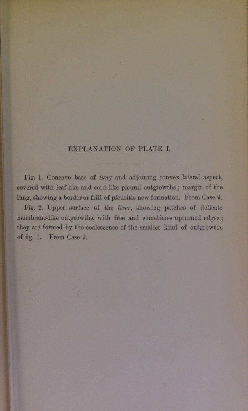 Fig. 1. Concave base of lung and adjoining convex lateral aspect, covered with leaf-like and cord-like pleural outgrowths; margin of the lung, showing a border or frill of pleuritic new formation. From Case 9. Fig. 2. Upper surface of the liver, showing patches of delicate membi’ane-like outgrowths, with free and sometimes upturned edges j they are formed by the coalescence of the smaller kind of outgrowths of fig. 1. From Case 9.