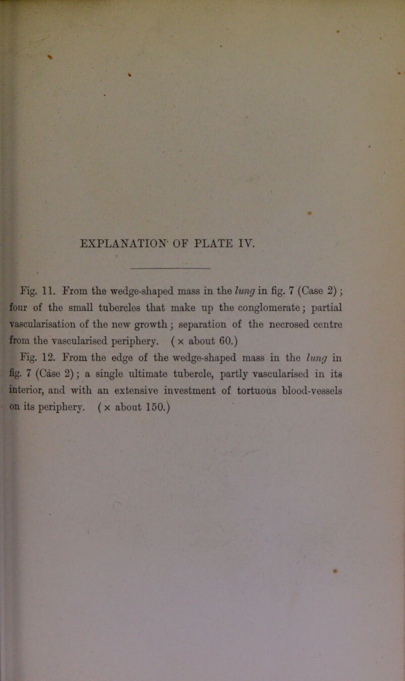 Fig. 11. From the wedge-shaped mass in the lung in fig. 7 (Case 2); four of the small tubercles that make up the conglomerate; partial vascularisation of the new growth ; separation of the necrosed centre from the vascularised periphery. ( x about 60.) Fig. 12. From the edge of the wedge-shaped mass in the lung in fig. 7 (Case 2); a single ultimate tubercle, partly vascularised in its / interior, and with an extensive investment of tortuous blood-vessels on its periphery. ( x about 150.)