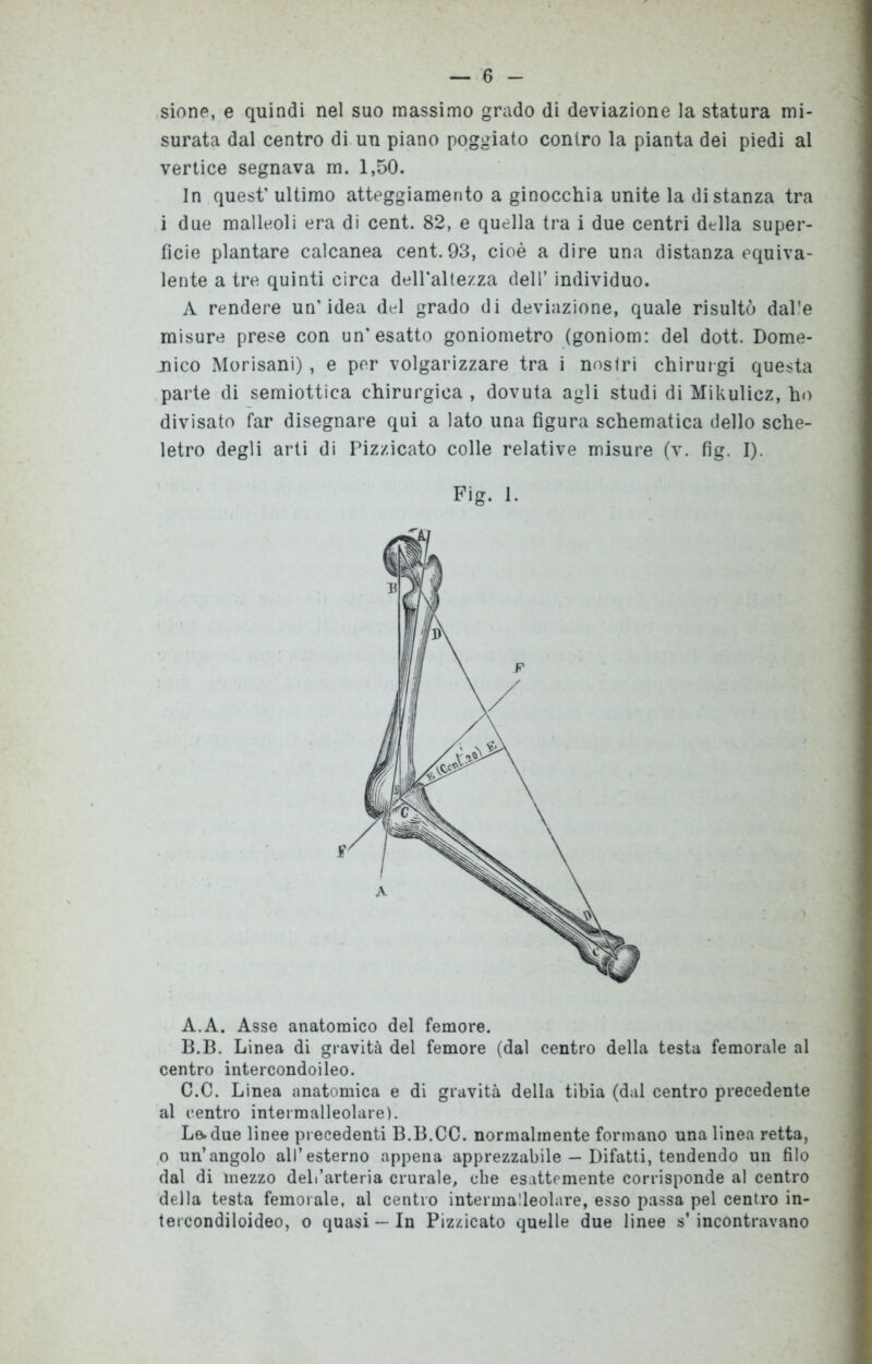 sione, e quindi nel suo massimo grado di deviazione la statura mi- surata dal centro di un piano poggiato contro la pianta dei piedi al vertice segnava m. 1,50. In quest’ ultimo atteggiamento a ginocchia unite la distanza tra i due malleoli era di cent. 82, e quella tra i due centri della super- ficie plantare calcanea cent. 93, cioè a dire una distanza equiva- lente a tre quinti circa deH'altezza dell’ individuo. A rendere un’idea del grado di deviazione, quale risultò dal’e misure prese con un'esatto goniometro (goniom: del dott. Dome- nico Morisani), e per volgarizzare tra i nostri chirurgi questa parte di semiottica chirurgica , dovuta agli studi di Mikulicz, ho divisato far disegnare qui a lato una figura schematica dello sche- letro degli arti di Pizzicato colle relative misure (v. fig. I). A. A. Asse anatomico del femore. B. B. Linea di gravità del femore (dal centro della testa femorale al centro intercondoileo. C. C. Linea anatomica e di gravità della tibia (dal centro precedente al centro intermalleolare). Le. due linee pi ecedenti B.B.CO. normalmente formano una linea retta, o un’angolo all’esterno appena apprezzabile — Difatti, tendendo un filo dal di mezzo dell’arteria crurale, che esattemente corrisponde al centro della testa femorale, al centro intermalleolare, esso passa pel centro in- tercondiloideo, o quasi — In Pizzicato quelle due linee s’incontravano Fig. 1.