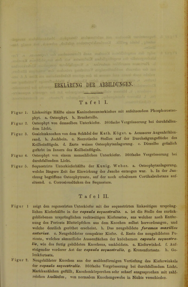 ERKLÄRUNG DER ABBILDUNGEN. Tafel I. Figur 1. Linkscitige Hälfte eines Kaninchenunterkiefers mit aulsitzendem Phosphoiosteo- phyt. a. Osteophyt. b. Bruchstelle. Figur 2. Osteophyt von demselben Unterkiefer. 360fache Vergrösserung bei duichfallen- dem Licht. Figur 3. Gesichtsknochen von dem Schädel der Kath. Köget. a. Aeusserer Augeuhöhlen- rand. b. Jochbein, c. Necrotische Stellen auf der Durchsägungsflüche des Keilbeinflügels, d. Zarte weisse Osteophytanlagerung. e. Dieselbe grünlich gefärbt im Innern des Keilbeinflügels. Figur 4. Osteophyt von einem menschlichen Unterkiefer. 360fache Vergrösserung bei durchfallendem Licht. Figur 5. Sequestrirte Unterkieferhälfte der Kunig. Weber, a. Osteophytanlagerung, welche längere Zeit der Einwirkung der Jauche entzogen war. b. In der Jau- chung begriffene Osteophytreste, auf der noch erhaltenen Cortikalsubstanz auf- sitzend. c. Corrosionslücken des Sequesters. Tafel II. Figur 1 zeigt den regenerirten Unterkiefer mit der sequestrirten linkseitigen ursprüng- lichen Kieferhälfte in der capsula sequestralis. a. ist die Stelle des zurück- gebliebenen ursprünglichen rechtseitigen Kieferastes, aus welcher nach Entfer- nung des Periosts Bluttröpfchen aus dem Knochen selbst hervordrangen, und welche deutlich geröthet erscheint, b. Das neugebildete foramen maacillae anterius. c. Neugebildeter compakter Kiefer, d. Reste des neugebildeten Pe- riosts, welches sämmtliche Aussenflächen der knöchernen capsula sequestra- hs, wie des fertig gebildeten Knochens, umkleidete, e. Kieferwinkel, f. Auf- steigender vorderer Ast der capsula sequestralis. g. Kronenfortsatz, h. Ge- lenkfortsatz. I igur 2. Neugebildeter Knochen aus der muldenförmigen Vertiefung des Kieferwinkels der capsula sequestralis. 360faclie Vergrösserung bei durchfallendem Licht. Markkanälchen gefüllt, Knochenkörperchensehr scharf ausgesprochen mit zahl- reichen Ausläufen, von normalem Knochengewebe in Nichts verschieden-