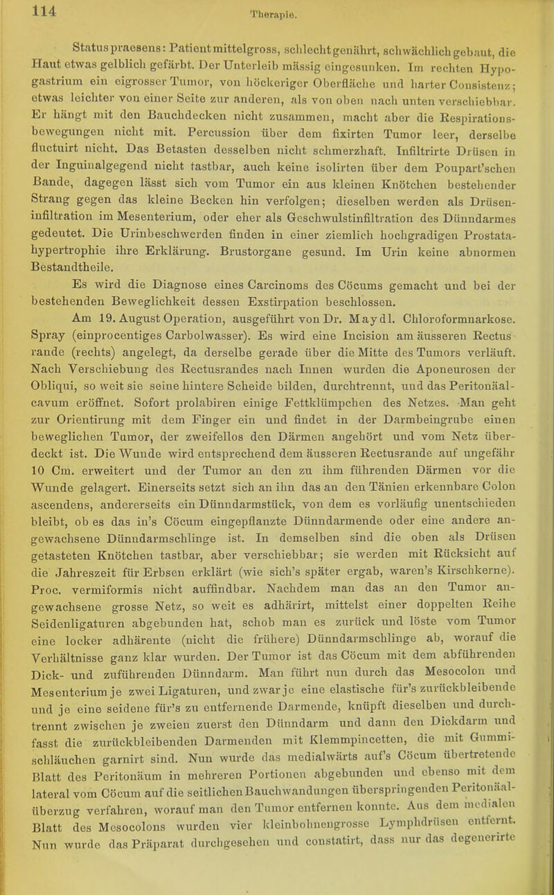 Status praesens: Patientmittelgross, schlecht genährt, schwächlich gebaut, die Haut etwas gelblich gefärbt. Der Unterleib mässig eingesunken. Im rechten Hypo- gastrium ein eigrosser Tumor, von höckeriger Oberfläche und harter Consistenz; etwas leichter von einer Seite zur anderen, als von oben nach unten verschiebbar. Er hängt mit den Bauchdecken nicht zusammen, macht aber die ßespirations- bewegungen nicht mit. Percussion über dem fixirten Tumor leer, derselbe fluctuirt nicht. Das Betasten desselben nicht schmerzhaft. Inflltrirte Drüsen in der Inguinalgegend nicht tastbar, auch keine isolirten über dem Poupart’schen Bande, dagegen lässt sich vom Tumor ein aus kleinen Knötchen bestellender Strang gegen das kleine Becken hin verfolgen; dieselben werden als Drüsen- infiltration im Mesenterium, oder eher als Geschwulstinfiltration des Dünndarmes gedeutet. Die Urinbeschwerden finden in einer ziemlich hochgradigen Prostata- hypertrophie ihre Erklärung. Brustorgane gesund. Im Urin keine abnormen Bestandtheile. Es wird die Diagnose eines Carcinoms des Cöcums gemacht und bei der bestehenden Beweglichkeit dessen Exstirpation beschlossen. Am 19. August Operation, ausgeführt von Dr. Maydl. Chloroformuarkose. Spray (einprocentiges Carbolwasser). Es wird eine Incision am äusseren Eectus rande (rechts) angelegt, da derselbe gerade über die Mitte des Tumors verläuft. Nach Verschiebung des Rectusrandes nach Innen wurden die Aponeurosen der Obliqui, so weit sie seine hintere Scheide bilden, durchtrennt, und das Peritonäal- cavum eröffnet. Sofort prolabiren einige Fettklümpchen des Netzes. Man geht zur Orientirung mit dem Finger ein und findet in der Darmbeingrnbe einen beweglichen Tumor, der zweifellos den Därmen angehört und vom Netz über- deckt ist. Die Wunde wird entsprechend dem äusseren Rectusrande auf ungefähr 10 Cm. erweitert und der Tumor an den zu ihm führenden Därmen vor die Wunde gelagert. Einerseits setzt sich an ihn das an den Tänien erkennbare Colon ascendens, andererseits ein Dünndarmstück, von dem es vorläufig unentschieden bleibt, ob es das in’s Cöcum eingepflanzte Dünndarmende oder eine andere an- gewachsene Dünndarmschlinge ist. In demselben sind die oben als Drüsen getasteten Knötchen tastbar, aber verschiebbar; sie werden mit Rücksicht auf die Jahreszeit für Erbsen erklärt (wie sich’s später ergab, waren's Kirschkerne). Proc. vermiformis nicht auffindbar. Nachdem man das an den Tumor an- gewachsene grosse Netz, so weit es adhärirt, mittelst einer doppelten Reihe Seidenligaturen abgebunden hat, schob man es zurück und löste vom Tumor eine locker adhärente (nicht die frühere) Dünndarmschiingo ab, worauf die Verhältnisse ganz klar wurden. Der Tumor ist das Cöcum mit dem abführenden Dick- und zuführendeu Dünndarm. Man führt nun durch das Mesocolon und Mesenterium je zwei Ligaturen, und zwar jo eine elastische für’s zurückbleibende und je eine seidene für’s zu entfernende Darmende, knüpft dieselben und duich- trennt zwischen je zweien zuerst den Dünndarm und dann den Diokdaim und fasst die zurückbleibenden Darmenden mit Klemmpincetten, die mit Gummi- schläuchen garnirt sind. Nun wurde das medialwärts auf’s Cöcum übertretende Blatt des Peritonäum in mehreren Portionen abgebunden und ebenso mit dem lateral vom Cöcum auf die seitlichen Bauch Wandungen überspringenden Peritonaal- überzug verfahren, worauf man den Tumor entfernen konnte. Aus dem medialen Blatt des Mcsocolons wurden vier kleinbohnengrosse Lymplulrüsen entfernt. Nun wurde das Präparat durcligesclien und constatirt, dass nur das degenenrte