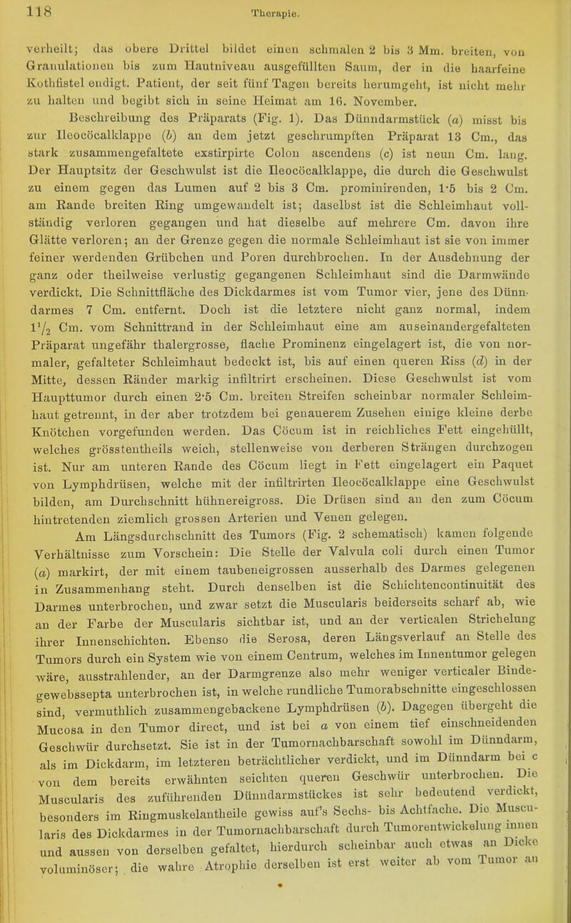verheilt; das obere Drittel bildet eineu schmalen 2 bis 3 Mm. breiten, von Granulationen bis zum Hautniveau ausgefüllten Saum, der in die haarfeine Kothfistel endigt. Patient, der seit fünf Tagen bereits herumgeht, ist nicht mehr zu halten und begibt sich in seine Heimat am 16. November. Beschreibung des Präparats (Fig. 1). Das Dünndarmstück (a) misst bis zur Iloocöcalklappe (b) an dem jetzt geschrumpften Präparat 13 Cm., das stark zusammengefaltete exstirpirte Colon ascendens (c) ist neun Cm. lang. Der Hauptsitz der Geschwulst ist die Heocöcalklappe, die durch die Geschwulst zu einem gegen das Lumen auf 2 bis 3 Cm. prominirenden, P5 bis 2 Cm. am Rande breiten Ring umgewandelt ist; daselbst ist die Schleimhaut voll- ständig verloren gegangen und hat dieselbe auf mehrere Cm. davon ihre Glätte verloren; an der Grenze gegen die normale Schleimhaut ist sie von immer feiner werdenden Grübchen und Poren durchbrochen. In der Ausdehnung der ganz oder theilweise verlustig gegangenen Schleimhaut sind die Darmwände verdickt. Die Schnittfläche des Dickdarmes ist vom Tumor vier, jene des Dünn- darmes 7 Cm. entfernt. Doch ist die letztere nicht ganz normal, indem 172 Cm. vom Schnittrand in der Schleimhaut eine am auseinandergefalteten Präparat ungefähr thalergrosse, flache Prominenz eingelagert ist, die von nor- maler, gefalteter Schleimhaut bedeckt ist, bis auf einen queren Riss (cl) in der Mitte, dessen Ränder markig infiltrirt erscheinen. Diese Geschwulst ist vom Haupttumor durch einen 2-5 Cm. breiten Streifen scheinbar normaler Schleim- haut getrennt, in der aber trotzdem bei genauerem Zusehen einige kleine derbe Knötchen vorgefunden werden. Das Cöcum ist in reichliches Fett eingehüllt, welches grösstentheils weich, stellenweise von derberen Strängen durchzogen ist. Nur am unteren Rande des Cöcum liegt in Fett eingelagert ein Paquet von Lymphdrüsen, welche mit der infiltrirten Heocöcalklappe eine Geschwulst bilden, am Durchschnitt hühnereigross. Die Drüsen sind an den zum Cöcum hintretenden ziemlich grossen Arterien und Venen gelegen. Am Längsdurchschnitt des Tumors (Fig. 2 schematisch) kamen folgende Verhältnisse zum Vorschein: Die Stelle der Valvula coli durch einen Tumoi (a) markirt, der mit einem taubeneigrossen ausserhalb des Darmes gelegenen ;Zusammenhang steht. Durch denselben ist die Schiclitencontinuität des Darmes unterbrochen, und zwar setzt die Muscularis beiderseits scharf ab, wie an der Farbe der Muscularis sichtbar ist, und an der verticalen Strichelung ihrer Innenschichten. Ebenso die Serosa, deren Längsverlauf an Stelle des Tumors durch ein System wie von einem Centrum, welches im Innentumor gelegen wäre, ausstrahlender, an der Darmgrenze also mehr weniger vertiealer Bmde- gewebssepta unterbrochen ist, in welche rundliche Tumorabschnitte eingeschlossen sind, vermuthlieh zusammengebackene Lymphdrüsen (6). Dagegen übergeht die Mucosa in den Tumor direct, und ist bei a von einem tief einschneidenden Geschwür durchsetzt. Sie ist in der Tumornachbarschaft sowohl im Dünndarm, als im Dickdarm, im letzteren beträchtlicher verdickt, und im Dünndarm bei c von dem bereits erwähnten seichten queren Geschwür unterbrochen. Die Muscularis des zuführenden Dünndarmstückes ist sehr bedeutend verdickt, besonders im Ringmuskelantlieile gewiss auf’s Sechs- bis Achtfache. Die Muscu- laris des Dickdarmes in der Tumornachbarschaft durch Tumorentwickelung innen und aussen von derselben gefaltet, hierdurch scheinbar auch etwas an Dicke voluminöser; die wahre Atrophie derselben ist erst weiter ab vom Tumor an