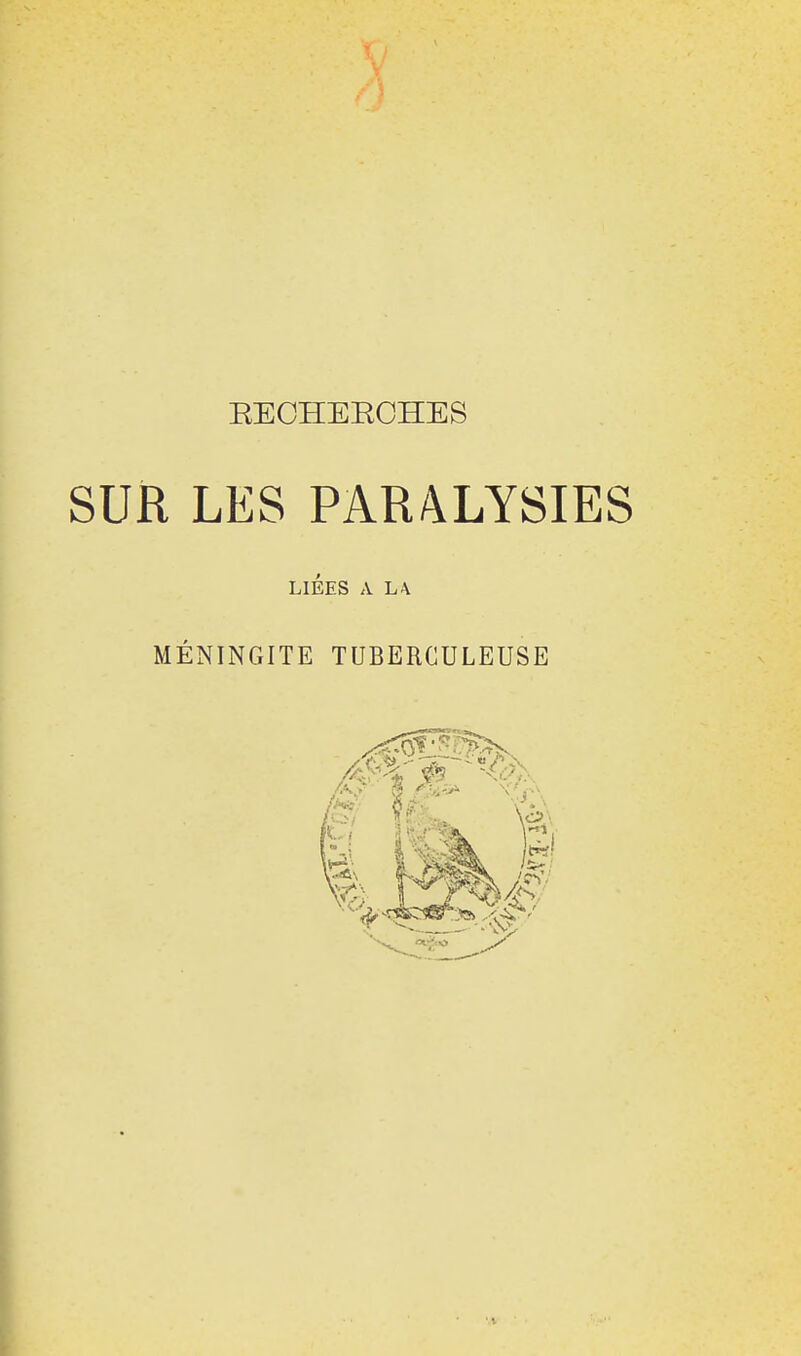 SUR LES PARALYSIES LIÉES A L\ MÉNINGITE TUBERCULEUSE