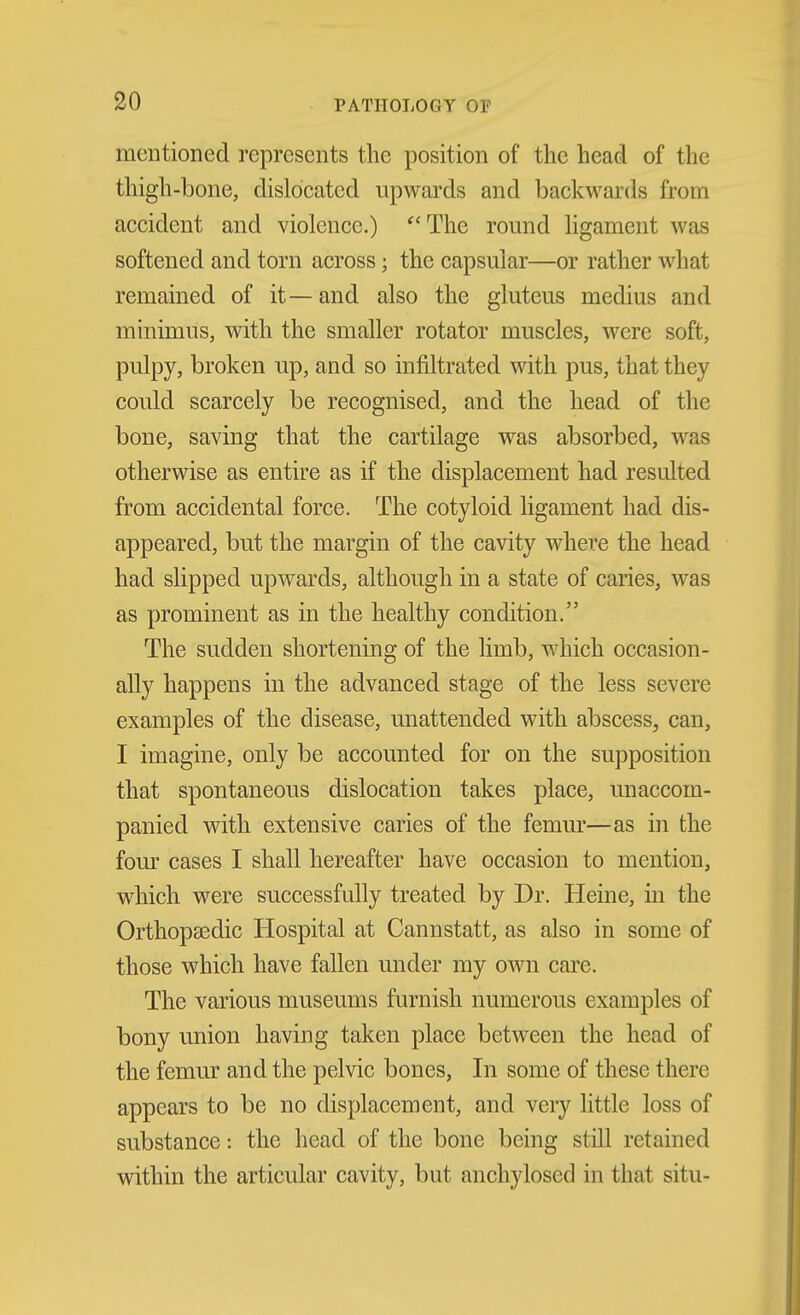 mentioned represents the position of the head of the thigh-bone, dislocated upwards and backwards from accident and violence.) ''The round ligament was softened and torn across; the capsular—or rather what remained of it—and also the gluteus medius and minimus, with the smaller rotator muscles, were soft, pulpy, broken up, and so infiltrated with pus, that they could scarcely be recognised, and the head of the bone, saving that the cartilage was absorbed, was otherwise as entire as if the displacement had resulted from accidental force. The cotyloid ligament had dis- appeared, but the margin of the cavity where the head had slipped upwards, although in a state of caries, was as prominent as in the healthy condition. The sudden shortening of the limb, which occasion- ally happens in the advanced stage of the less severe examples of the disease, unattended with abscess, can, I imagine, only be accounted for on the supposition that spontaneous dislocation takes place, unaccom- panied with extensive caries of the femm'—as in the four cases I shall hereafter have occasion to mention, which were successfully treated by Dr. Heine, in the Orthopaedic Hospital at Cannstatt, as also in some of those which have fallen under my own care. The various museums furnish numerous examples of bony union having taken place between the head of the femur and the pelvic bones. In some of these there appears to be no displacement, and very little loss of substance: the head of the bone being still retained within the articular cavity, but anchylosed in that situ-