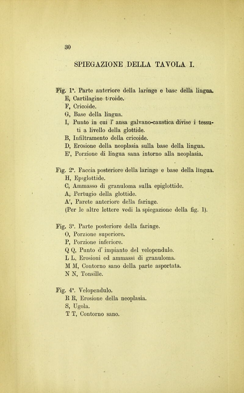 SPIEGAZIONE DELLA TAVOLA L Fig. 1*. Parte anteriore della laringe e base della lingua. E, Cartilagine tiroide. F, Cricoide. G, Base della lingua. I, Punto in cui 1' ansa galvano-caustica divise i tessu- ti a livello della glottide. B, Infiltramento della cricoide. D, Erosione della neoplasia sulla base della lingua. E', Porzione di lingua sana intorno alla neoplasia. Fig. 2^. Faccia posteriore della laringe e base della lingua, H, Epiglottide. C, Ammasso dì granuloma sulla epiglottide. A, Pertugio della glottide. A', Parete anteriore della faringe. (Per le altre lettere vedi la spiegazione della fig. 1). Fig. 3^. Parte posteriore della faringe. 0, Porzione superiore. P, Porzione inferiore. Q Q, Punto d' impianto del velopendulo. L L, Erosioni ed ammassi di granuloma. M M, Contorno sano della parte asportata. N N, Tonsille. Fig. 4^. Velopendulo. E K, Erosione della neoplasia. S, Ugola. T T, Contorno sano.