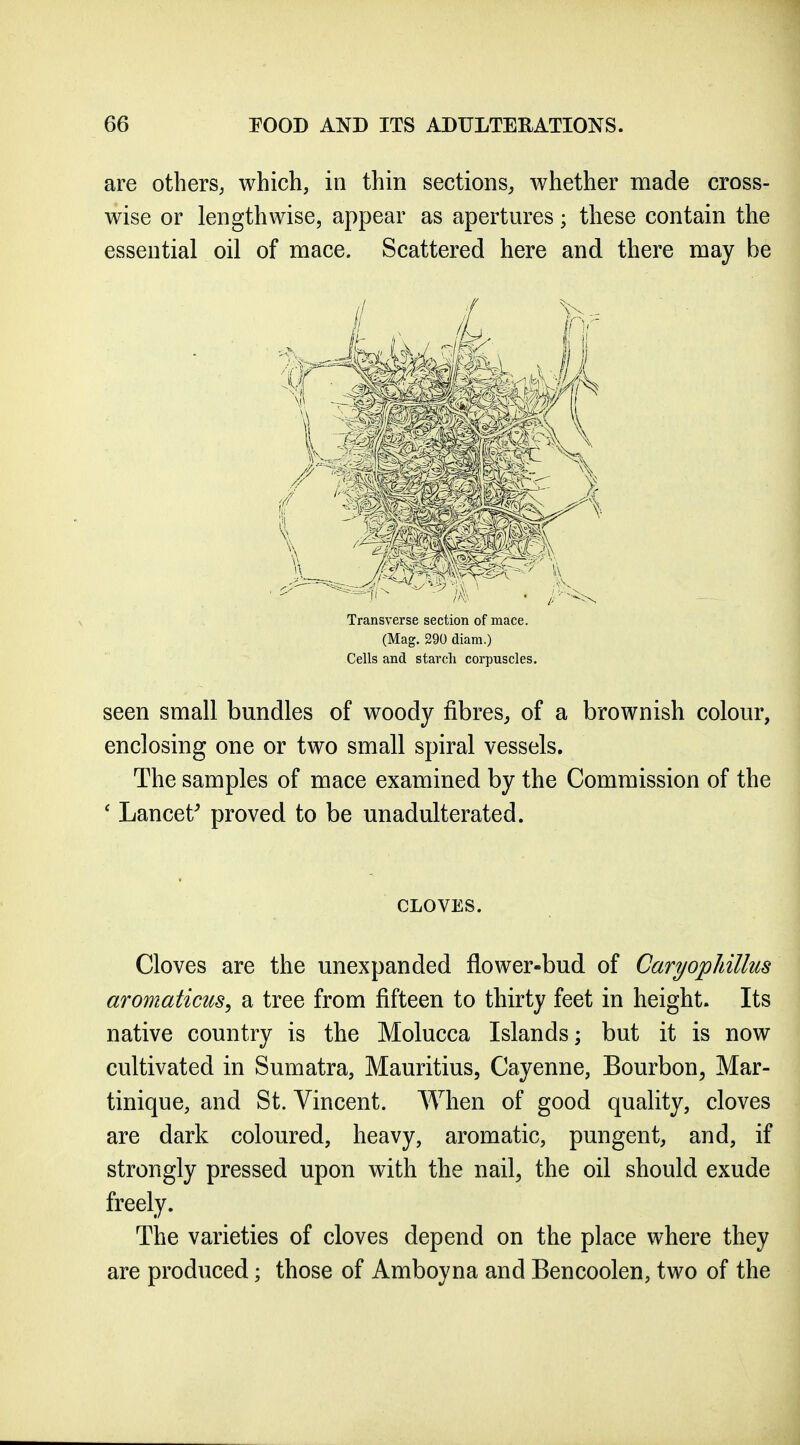 are otherS; which, in thin sections, whether made cross- wise or lengthwise, appear as apertures; these contain the essential oil of mace. Scattered here and there may be seen small bundles of woody fibres, of a brownish colour, enclosing one or two small spiral vessels. The samples of mace examined by the Commission of the ' Lancet' proved to be unadulterated. Cloves are the unexpanded flower-bud of Caryophillus aromaticus, a tree from fifteen to thirty feet in height. Its native country is the Molucca Islands; but it is now cultivated in Sumatra, Mauritius, Cayenne, Bourbon^ Mar- tinique, and St. Vincent. When of good quality, cloves are dark coloured, heavy, aromatic, pungent, and, if strongly pressed upon with the nail^ the oil should exude freely. The varieties of cloves depend on the place where they are produced; those of Amboyna and Bencoolen, two of the Transverse section of mace. (Mag. 290 diam.) Cells and starch corpuscles. CLOVES.
