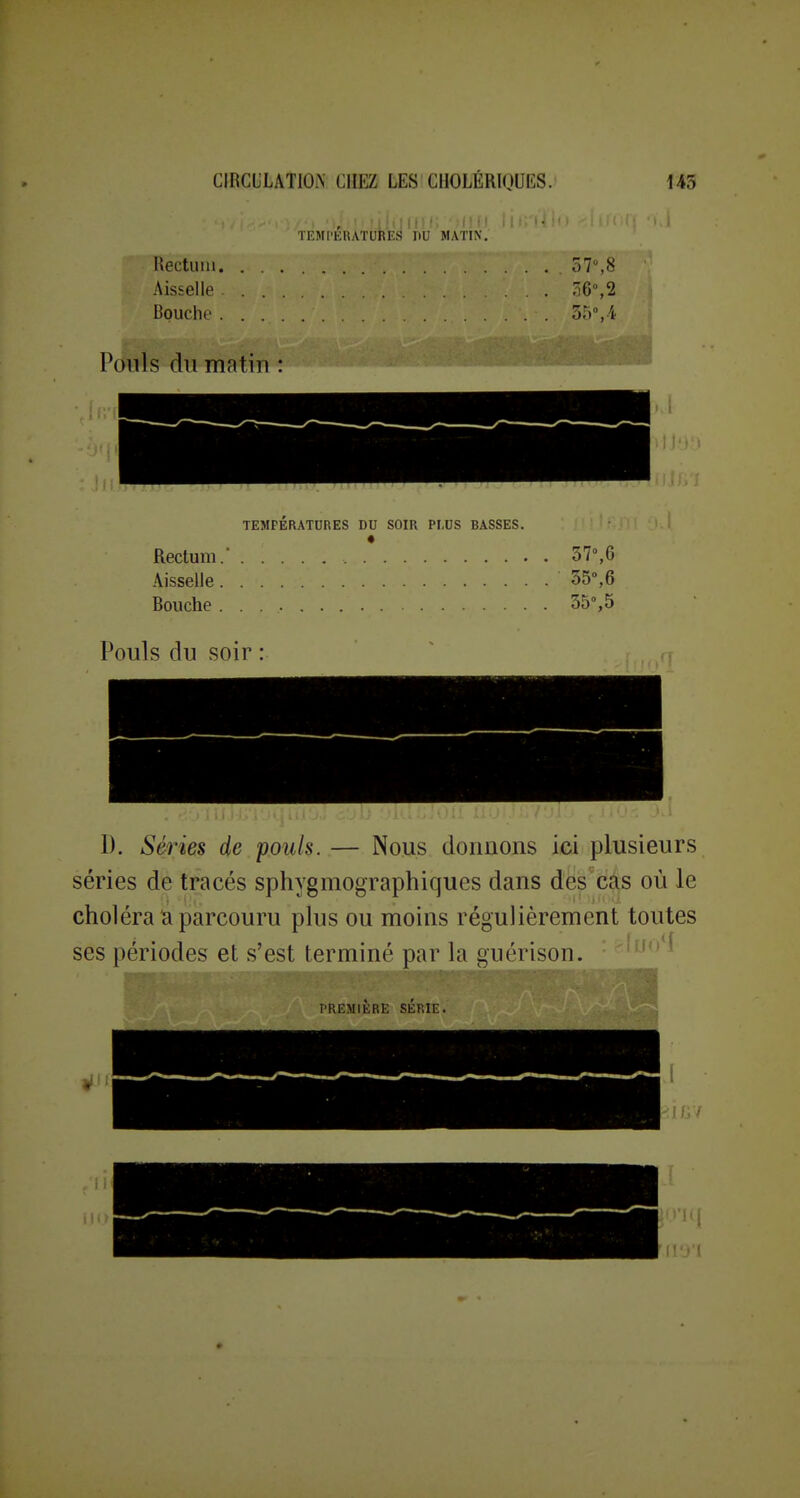 TEMPKUATURES DU MATIN. Uectuiii 57,8 AisseHe 56°,2 Bouche 35% 4 Pouls du matin : TEMPÉRATURES DU SOIR PLUS BASSES. Rectum. 37%6 AisseUe 55°,6 Bouche 35%5 Pouls du soir : I). Séries de poids. — Nous donnons ici plusieurs séries de tracés sphygmographiques dans des cas où le choléra la parcouru plus ou moins régulièrement toutes ses périodes et s'est termiiK' pnr 1;i <;ii('rison. * '^^^''^ PREMIERE SERIE.