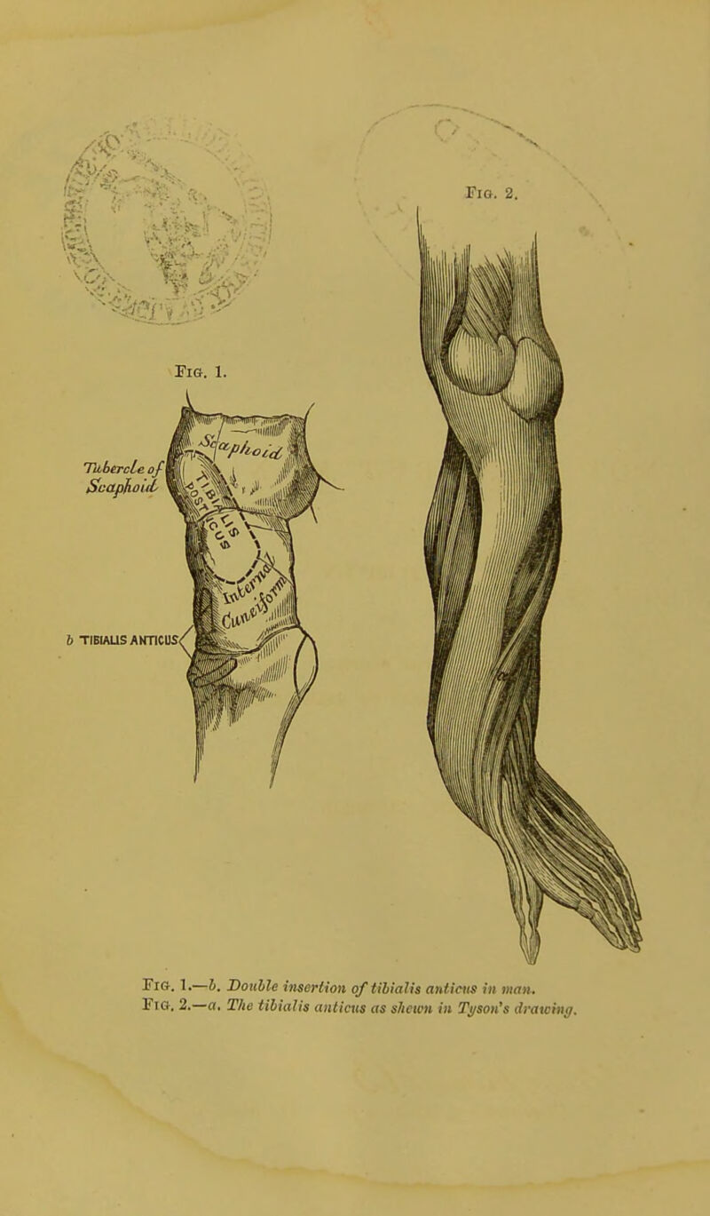 Fig. 1.—i. Double insertion of tibialis antiats in man. Fig. 2.—a. The tibialis aiitictis as sJicwn in Tj/son's drawinc/.