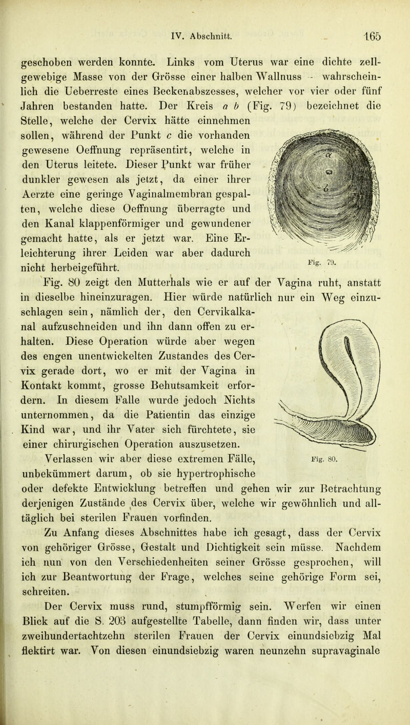 geschoben werden konnte, Links vom Uterus war eine dichte zell- gewebige Masse von der Grösse einer halben Wallnuss - wahrschein- lich die Ueberreste eines Beckenabszesses, welcher vor vier oder fünf Jahren bestanden hatte. Der Kreis a h (Fig. 79) bezeichnet die Stelle, welche der Cervix hätte einnehmen sollen, während der Punkt c die vorhanden gewesene Oeifnung repräsentirt, welche in den Uterus leitete. Dieser Punkt war früher dunkler gewesen als jetzt, da einer ihrer Aerzte eine geringe Vaginalmembran gespal- ten, welche diese Oeffnung überragte und den Kanal klappenförmiger und gewundener gemacht hatte, als er jetzt war. Eine Er- leichterung ihrer Leiden war aber dadurch nicht herbeigeführt. Fig. 80 zeigt den Mutterhals wie er auf der Yagina ruht, anstatt in dieselbe hineinzuragen. Hier würde natürlich nur ein Weg einzu- schlagen sein, nämlich der, den Cervikalka- nal aufzuschneiden und ihn dann offen zu er- halten. Diese Operation würde aber wegen des engen unentwickelten Zustandes des Cer- vix gerade dort, wo er mit der Vagina in Kontakt kommt, grosse Behutsamkeit erfor- dern. In diesem Falle wurde jedoch Nichts unternommen, da die Patientin das einzige Kind war, und ihr Vater sich fürchtete, sie einer chirurgischen Operation auszusetzen. Verlassen wir aber diese extremen Fälle, Fig. so. unbekümmert darum, ob sie hypertrophische oder defekte Entwicklung betreffen und gehen wir zur Betrachtung derjenigen Zustände des Cervix über, welche wir gewöhnlich und all- täglich bei sterilen Frauen vorfinden. Zu Anfang dieses Abschnittes habe ich gesagt, dass der Cervix von gehöriger Grösse, Gestalt und Dichtigkeit sein müsse. Nachdem ich nun von den Verschiedenheiten seiner Grösse gesprochen, will ich zur Beantwortung der Frage, welches seine gehörige Form sei, schreiten. Der Cervix muss rund, stumpfförmig sein. Werfen wir einen Blick auf die S. 203 aufgestellte Tabelle, dann finden wir, dass unter zweihundertachtzehn sterilen Frauen der Cervix einundsiebzig Mal flektirt war. Von diesen einundsiebzig waren neunzehn supravaginale