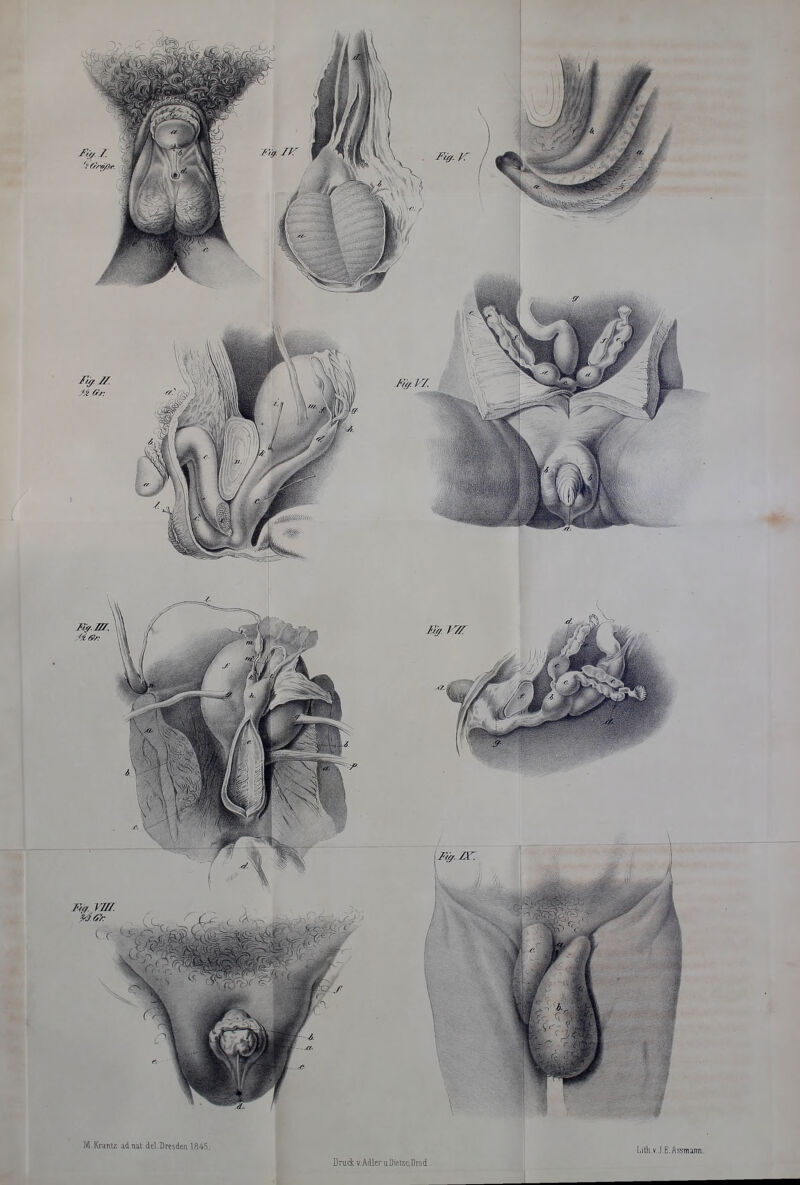M.Kruntz ad nat.del.Dresden 1845. Lifti.v.J.E.Assntann. Druck v.Adler u.Dietie.Ursd.