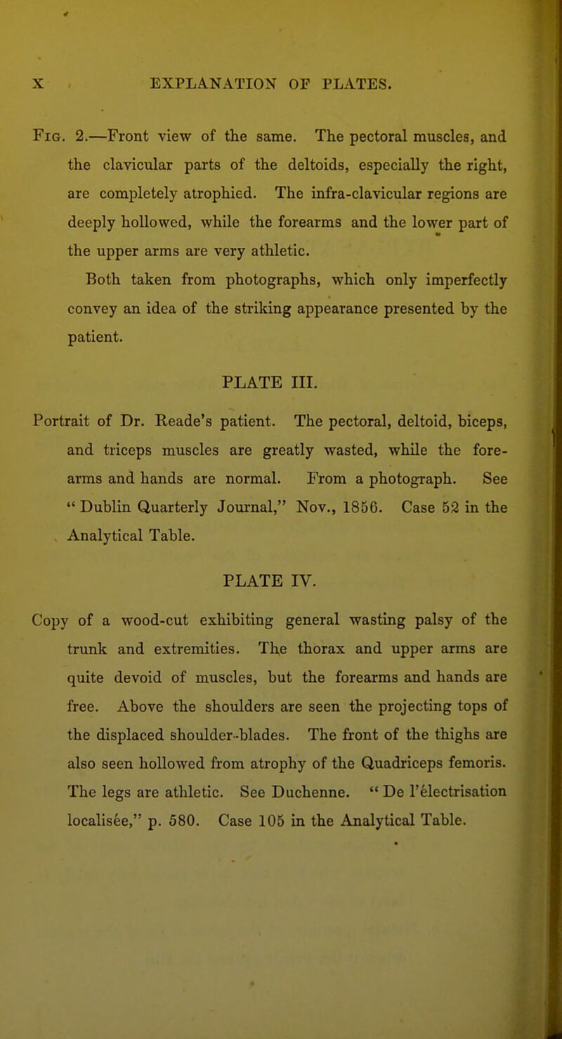 Fig. 2.—Front view of the same. The pectoral muscles, and the clavicular parts of the deltoids, especially the right, are completely atrophied. The infra-clavicular regions are deeply hollowed, while the forearms and the lower part of the upper arms are very athletic. Both taken from photographs, which only imperfectly convey an idea of the striking appearance presented by the patient. PLATE III. Portrait of Dr. Reade's patient. The pectoral, deltoid, biceps, and triceps muscles are greatly wasted, while the fore- arms and hands are normal. From a photograph. See » Dublin Quarterly Journal, Nov., 1856. Case 52 in the , Analytical Table. PLATE IV. Copy of a wood-cut exhibiting general wasting palsy of the trunk and extremities. The thorax and upper arms are quite devoid of muscles, but the forearms and hands are free. Above the shoulders are seen the projecting tops of the displaced shoulder-blades. The front of the thighs are also seen hollowed from atrophy of the Quadriceps femoris. The legs are athletic. See Duchenne.  De 1'electrisation localisee, p. 580. Case 105 in the Analytical Table.