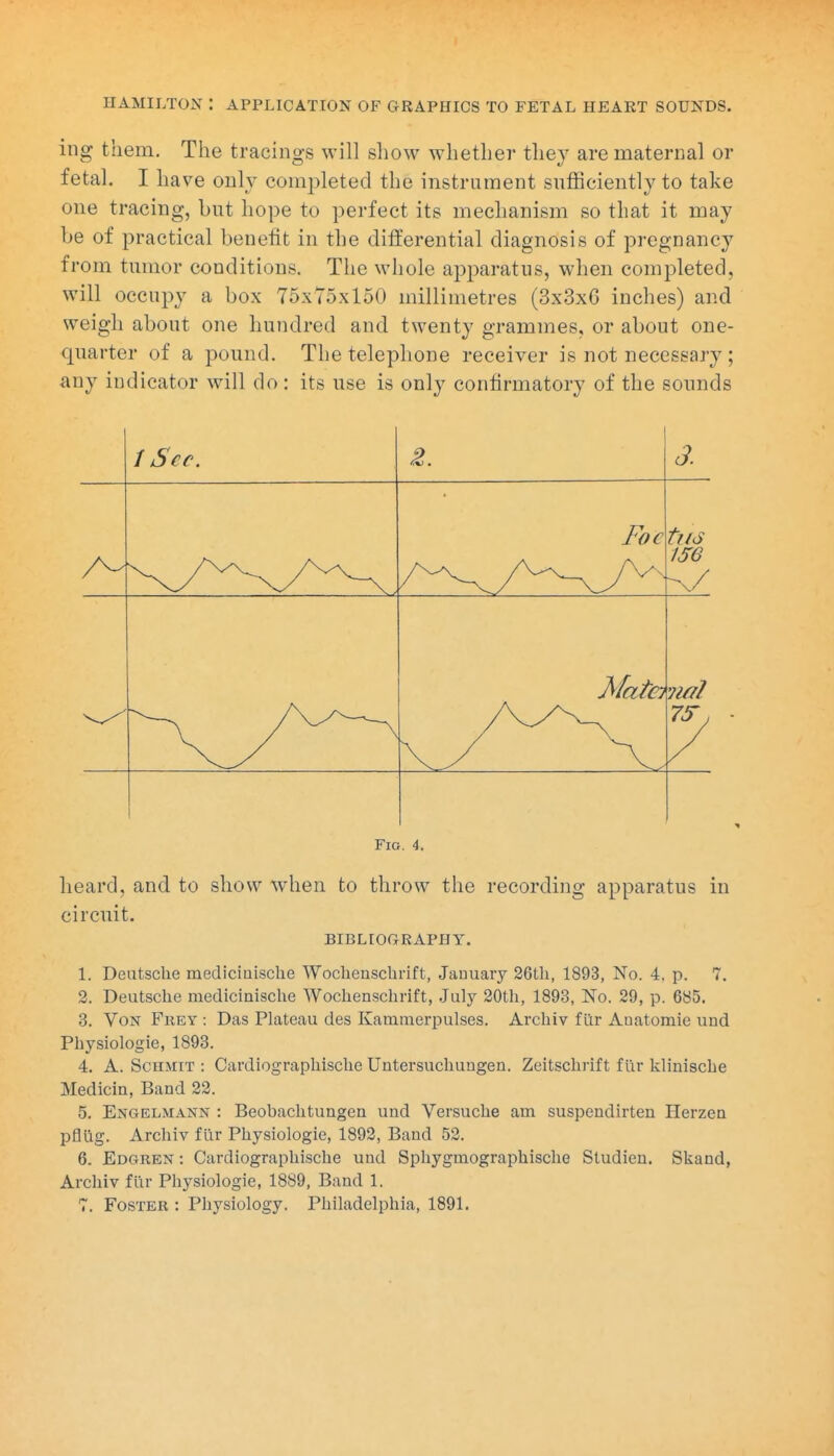 HAMILTON : APPLICATION OF GRAPHICS TO FETAL HEART SOUNDS. ing them. The tracings will show whether they are maternal or fetal. I have only completed the instrument sufficiently to take one tracing, but hope to perfect its mechanism so that it may be of practical benefit in tbe differential diagnosis of pregnancy from tumor conditions. The whole apparatus, when completed, will occupy a box 75x75x150 millimetres (3x3x6 inches) and weigh about one hundred and twenty grammes, or about one- qnarter of a pound. The telephone receiver is not necessary ; any indicator will do: its use is only confirmatory of the sounds i Sec. 3. Foe ise ^/ Mate? 'ml Fig. 4. lieard, and to show when to throw the recording apparatus in circuit. BIBLIOGRAPHY. 1. Deutsche mediciaisclie Wochenschrift, Jauuaiy 26tli, 1893, No. 4. p. 7. 2. Deutsche medicinische Wochenschrift, July 20th, 1893, No. 29, p. 685. 3. Von Frey : Das Plateau des Kammerpulses. Archiv fur Anatomie und Physiologic, 1893. 4. A. ScH.MiT : Cardiographische Untersuchungen. Zeitschrift fur klinische Medicin, Band 22. 5. Engelmann : Beobachtungen und Versuche am suspendirten Herzea pflug. Archiv fur Physiologic, 1892, Band 52. 6. Edgren : Cardiographische und Sphygmographische Studieu. Skand, Archiv fur Physiologie, 1889, Band 1. 7. Foster : Physiology. Philadelphia, 1891.