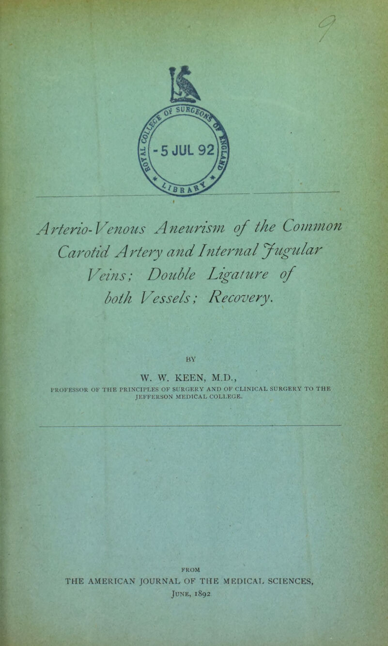 Arterio-Venotis Aneurisfn of the Common Carotid Artery and Internal J^lg^llar Veins; Double Ligat^tre of both Vessels; Recovery. BY W. W. KEEN, M.D., l-ROFESSOR OF THE PRINCIPLES OF SURGERY AND OF CLINICAL SURGERY TO THE JEFFERSON MEDICAL COLLEGE. FROM THE AMERICAN JOURNAL OF THE MEDICAL SCIENCES, June, 1892